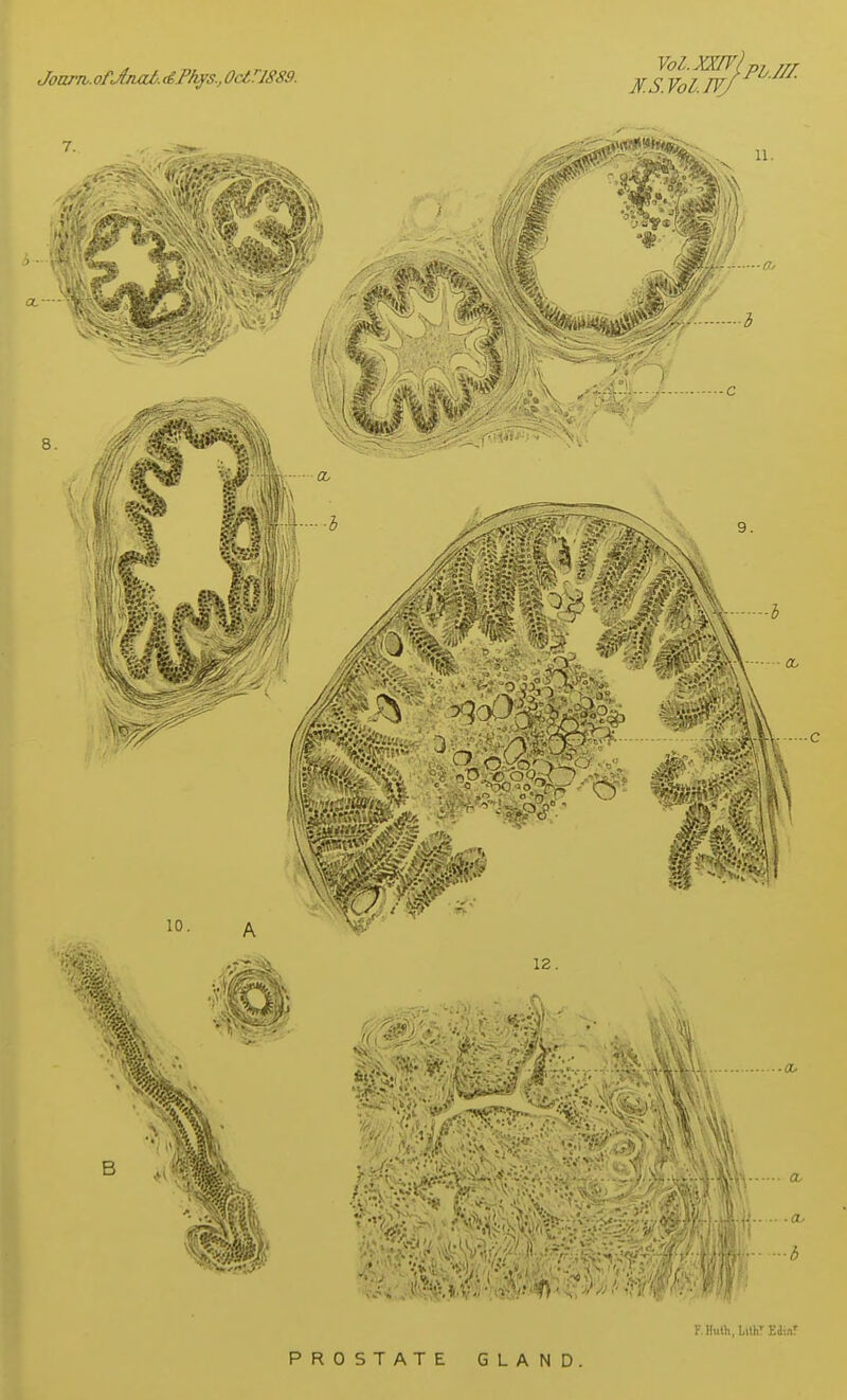 Joarw. ofJnai. dFkys., 0clr1889. Vol.WV)pu// N.S.Vol.IVf 7. Ml? Jr-i - /// ''^K^ <}/<■• Mr 11. ■w if**:?-- 8. ■ a. p i 10. 11 i£vV - sit - -?v#y> 12. Mi i -a. ... a, .. .a, -3 F Huth, Lith' EdinT