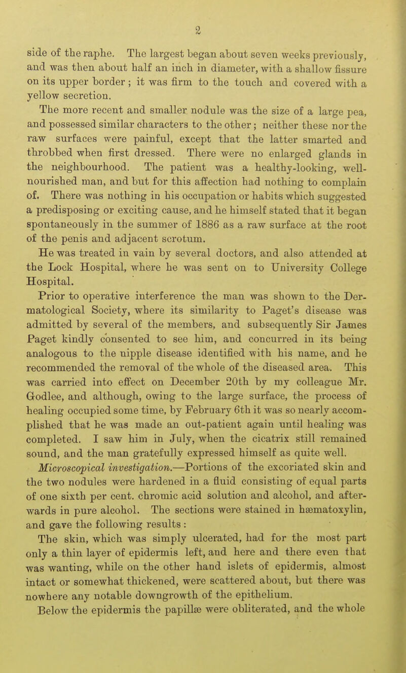 side of the raphe. The largest began about seven weeks previously, and was then about half an inch in diameter, with a shallow fissure on its upper border ; it was firm to the touch and covered with a yellow secretion. The more recent and smaller nodule was the size of a large pea, and possessed similar characters to the other; neither these nor the raw surfaces were painful, except that the latter smarted and throbbed when first dressed. There were no enlarged glands in the neighbourhood. The patient was a healthy-looking, well- nourished man, and but for this affection had nothing to complain of. There was nothing in his occupation or habits which suggested a predisposing or exciting cause, and he himself stated that it began spontaneously in the summer of 1886 as a raw surface at the root of the penis and adjacent scrotum. He was treated in vain by several doctors, and also attended at the Lock Hospital, where he was sent on to University College Hospital. Prior to operative interference the man was shown to the Der- matological Society, where its similarity to Paget's disease was admitted by several of the members, and subsequently Sir James Paget kindly consented to see him, and concurred in its being analogous to the nipple disease identified with his name, and he recommended the removal of the whole of the diseased area. This was carried into effect on December 20th by my colleague Mr. Godlee, and although, owing to the large surface, the process of healing occupied some time, by February 6th it was so nearly accom- plished that he was made an out-patient again until healing was completed. I saw him in July, when the cicatrix still remained sound, and the man gratefully expressed himself as quite well. Microscopical investigation.—Portions of the excoriated skin and the two nodules were hardened in a fluid consisting of equal parts of one sixth per cent, chromic acid solution and alcohol, and after- wards in pure alcohol. The sections were stained in haematoxylin, and gave the following results : The skin, which was simply ulcerated, had for the most part only a thin layer of epidermis left, and here and there even that was wanting, while on the other hand islets of epidermis, almost intact or somewhat thickened, were scattered about, but there was nowhere any notable downgrowth of the epithelium. Below the epidermis the papillae were obliterated, and the whole