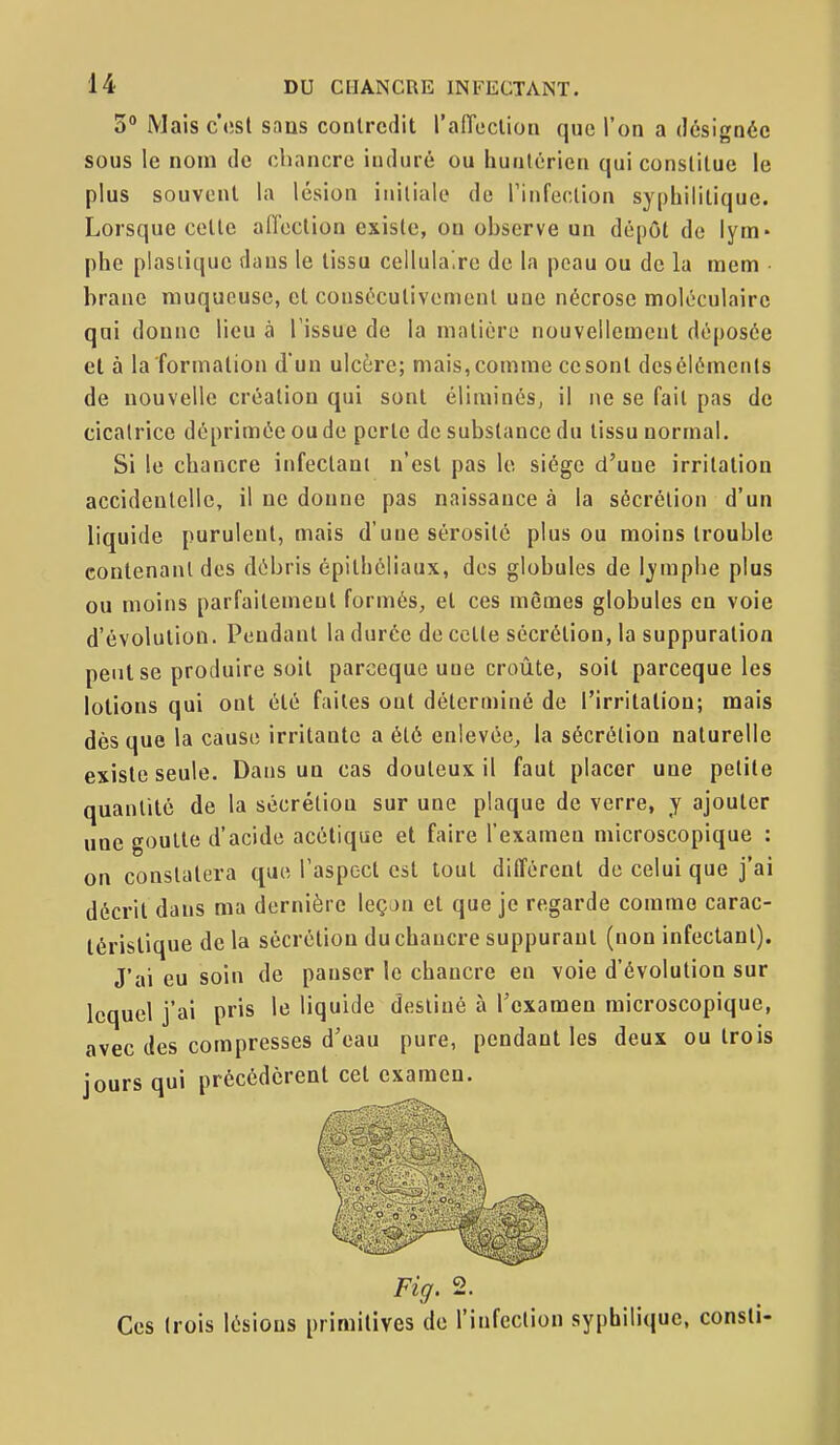 3° Mais c'est sans contredit l'alTeclion que l'on a désignée sous le nom de chancre induré ou huntérien qui constitue le plus souvent la lésion initiale de rinfection syphilitique. Lorsque cette affection existe, ou observe un dépôt do lym- phe plastique dans le tissu cellula.re de la peau ou de la mem brane muqueuse, et cousécutivenieut une nécrose moléculaire qui donne lieu à l'issue de la matière nouvellement déposée et à la formation d'un ulcère; mais,comme ce sont desélémcnls de nouvelle création qui sont éliminés, il ne se fait pas de cicatrice déprimée ou de perte de substance du tissu normal. Si le chancre infectant n'est pas le siège d'une irritation accidentelle, il ne donne pas naissance à la sécrétion d'un liquide purulent, mais d'une sérosité plus ou moins trouble contenant des débris épithéliaux, des globules de lymphe plus ou moins parfaitement formés, et ces mêmes globules en voie d'évolution. Pondant la durée de cette sécrétion, la suppuration peut se produire soit parceque uue croûte, soil parceque les lotions qui ont été faites ont déterminé de l'irritation; mais dès que la cause irritante a été enlevée^ la sécrétion naturelle existe seule. Dans un cas douteux il faut placer une petite quantité de la sécrétion sur une plaque de verre, y ajouter uue goutte d'acide acétique et faire l'examen microscopique : on constatera que l'aspect est tout différent de celui que j'ai décrit dans ma dernière leçon et que je regarde comme carac- téristique de la sécrétion du chancre suppurant (non infectant). J'ai eu soin de panser le chancre en voie d'évolution sur lequel j'ai pris le liquide destiné à rcxamea microscopique, avec des compresses d'eau pure, pendant les deux ou trois jours qui précédèrent cet examen. Fig. 2. Ces trois lésions primitives de l'infection syphiliquc, consti-