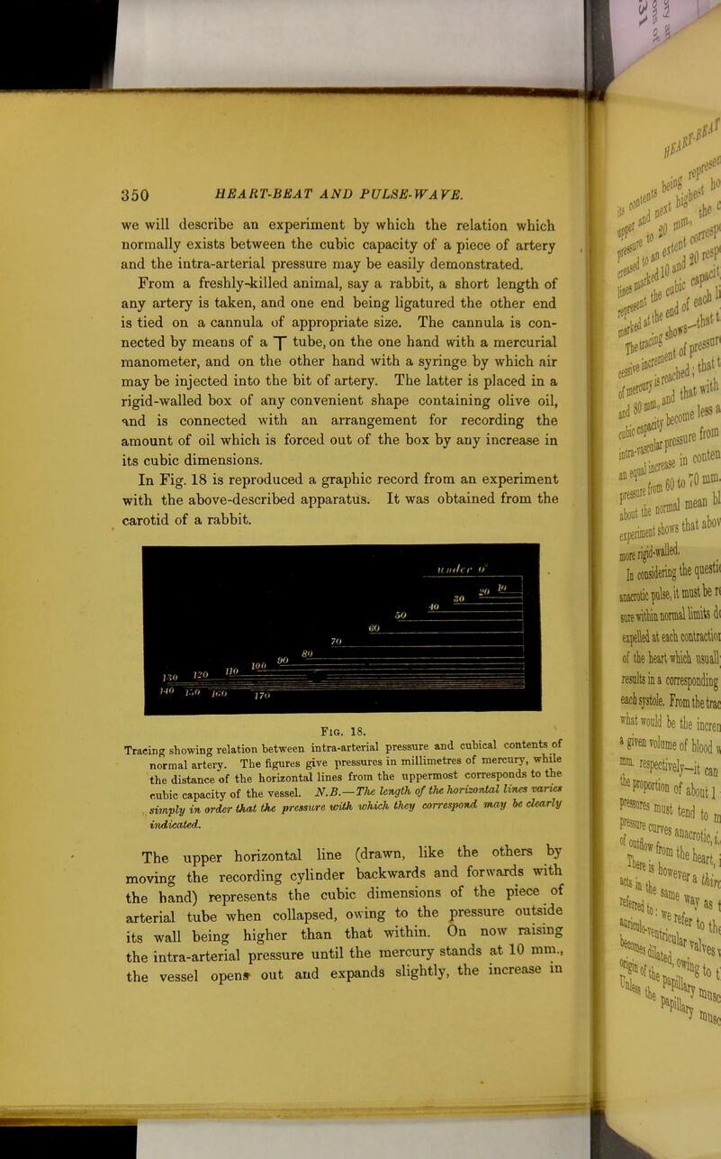 we will describe an experiment by which the relation which normally exists between the cubic capacity of a piece of artery and the intra-arterial pressure may be easily demonstrated. From a freshly-killed animal, say a rabbit, a short length of any artery is taken, and one end being ligatured the other end is tied on a cannula of appropriate size. The cannula is con- nected by means of a f tube, on the one hand with a mercurial manometer, and on the other hand with a syringe by which air may be injected into the bit of artery. The latter is placed in a rigid-walled box of any convenient shape containing olive oil, and is connected with an arrangement for recording the amount of oil which is forced out of the box by any increase in its cubic dimensions. In Fig. 18 is reproduced a graphic record from an experiment with the above-described apparatus. It was obtained from the carotid of a rabbit. Fig. 18. Tracing showing relation between intra-arterial pressure and cubical contents of normal artery. The figures give pressures in millimetres of mercurj', while the distance of the horizontal lines from the uppermost corresponds to the cubic capacity of the vessel. N.B.-Thc length of m horizontal liruts varvis . siinply in order that the pressure with which they correspond may be clearly indicated. The upper horizontal line (drawn, like the others by moving the recording cylinder backwards and forwards with the hand) represents the cubic dimensions of the piece of arterial tube when collapsed, owing to the pressure outside its wall being higher than that within. On now raising the intra-arterial pressure until the mercury stands at 10 mm., the vessel open* out and expands slightly, the increase m .if rep' set c aci', Tbeti«c'°?;f pressor' more rigid-walled. Id considering tkquestK anacrotic pulse, iiwt ben STO witliin normal liiniUdi exjieM at eacb conliaclioi ofthelieartwliicli iisuall; results in a correspondiDg eaciisjstole, From the trac ^iatwldbetlie increr > given volume of blood V r«pectively-it m ^^Foportionofaboutl ;^^^>n«sttend ton •Sri?*