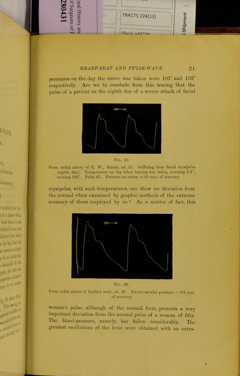 W g o o (Tl (-1 C E a. I£ to ITi!;^RT-BEAT AND PULSE-WAVE. 21 peratures on the day the curve was taken were 101° and 103° respectively. Are we to conclude from this tracing that the pulse of a patient on the eighth day of a severe attack of facial Fig. 28. From radial artery of E. W., female, eet. 51. Suffering from facial erysipelas (eiglitli day). Temperature on day when tracing was taken, morning 101°, evening 103°. Pulse 65. Pressure on artery = 60 mm. of mercury. erysipelas, with such temperatures, can show no deviation from the normal when examined by graphic methods of the extreme accuracy of those employed by us ? As a matter of fact, this Fig. 29. From radial artery of healtliy male, set. 36. Extra-vascular pressure = 100 mm. of mercury. woman's pulse, although of the normal form, presents a very important deviation from the normal pulse of a woman of fifty. The blood-pressure, namely, has fallen considerably. The greatest oscillations of the lever were obtained with an extra-