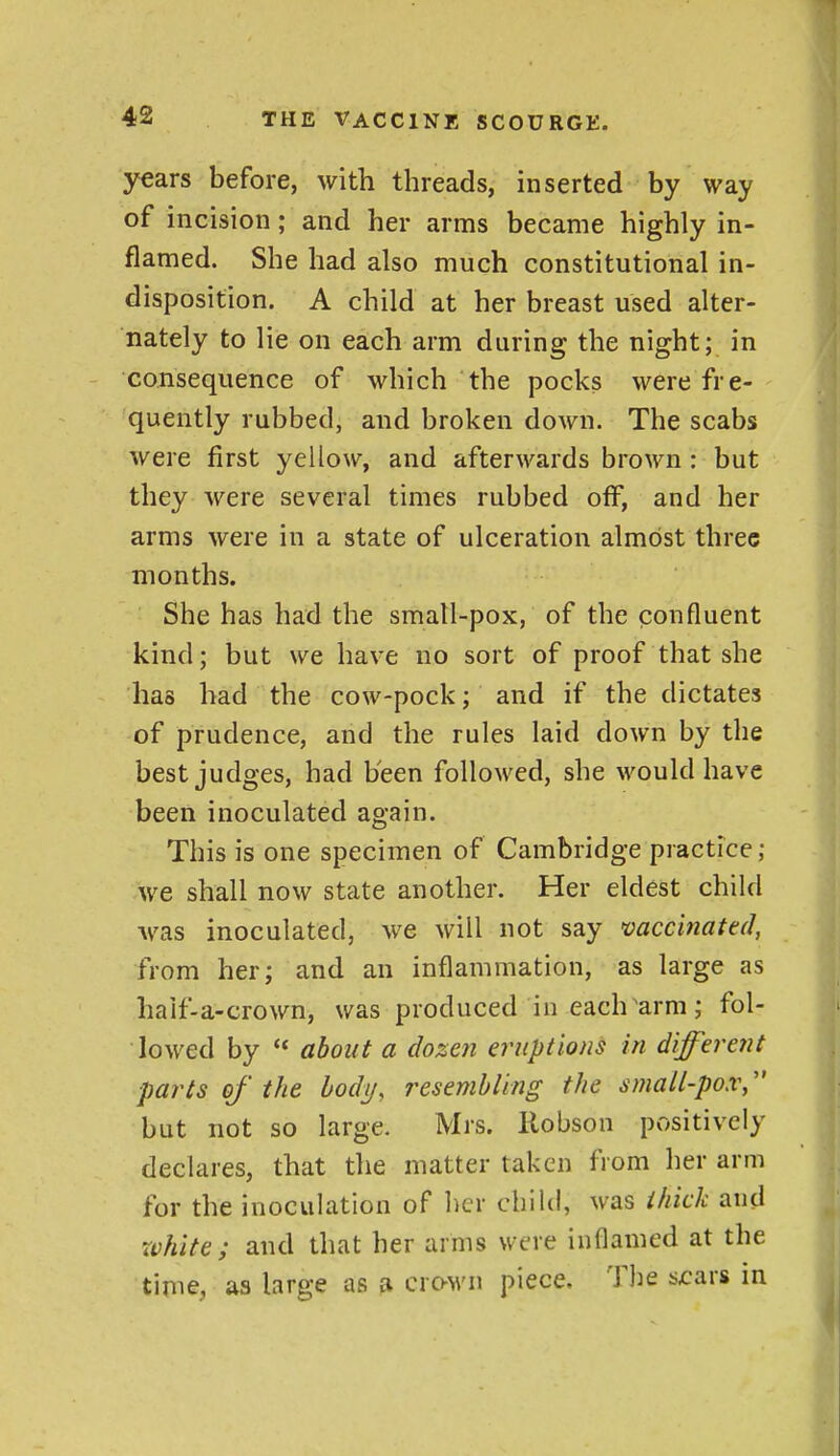 years before, with threads, inserted by way of incision; and her arms became highly in- flamed. She had also much constitutional in- disposition. A child at her breast used alter- nately to lie on each arm during the night; in consequence of which the pocks were fre- quently rubbed, and broken down. The scabs were first yellow^, and afterwards brown : but they were several times rubbed off, and her arms were in a state of ulceration almost three months. She has had the smatl-pox, of the confluent kind; but we have no sort of proof that she has had the cow-pock; and if the dictates of prudence, and the rules laid down by the best judges, had been followed, she would have been inoculated again. This is one specimen of Cambridge practice; we shall now state another. Her eldest child was inoculated, we will not say >caccmated, from her; and an inflammation, as large as half-a-crown, was produced in each arm; fol- lowed by  about a dozen eruptions in different ■parts of the hody, resemhUng the small-pox, but not so large. Mrs. Robson positively declares, that the matter taken from her arm for the inoculation of her child, was thick and white; and that her arms were inflamed at the time, as large as a crown piece. The scars in