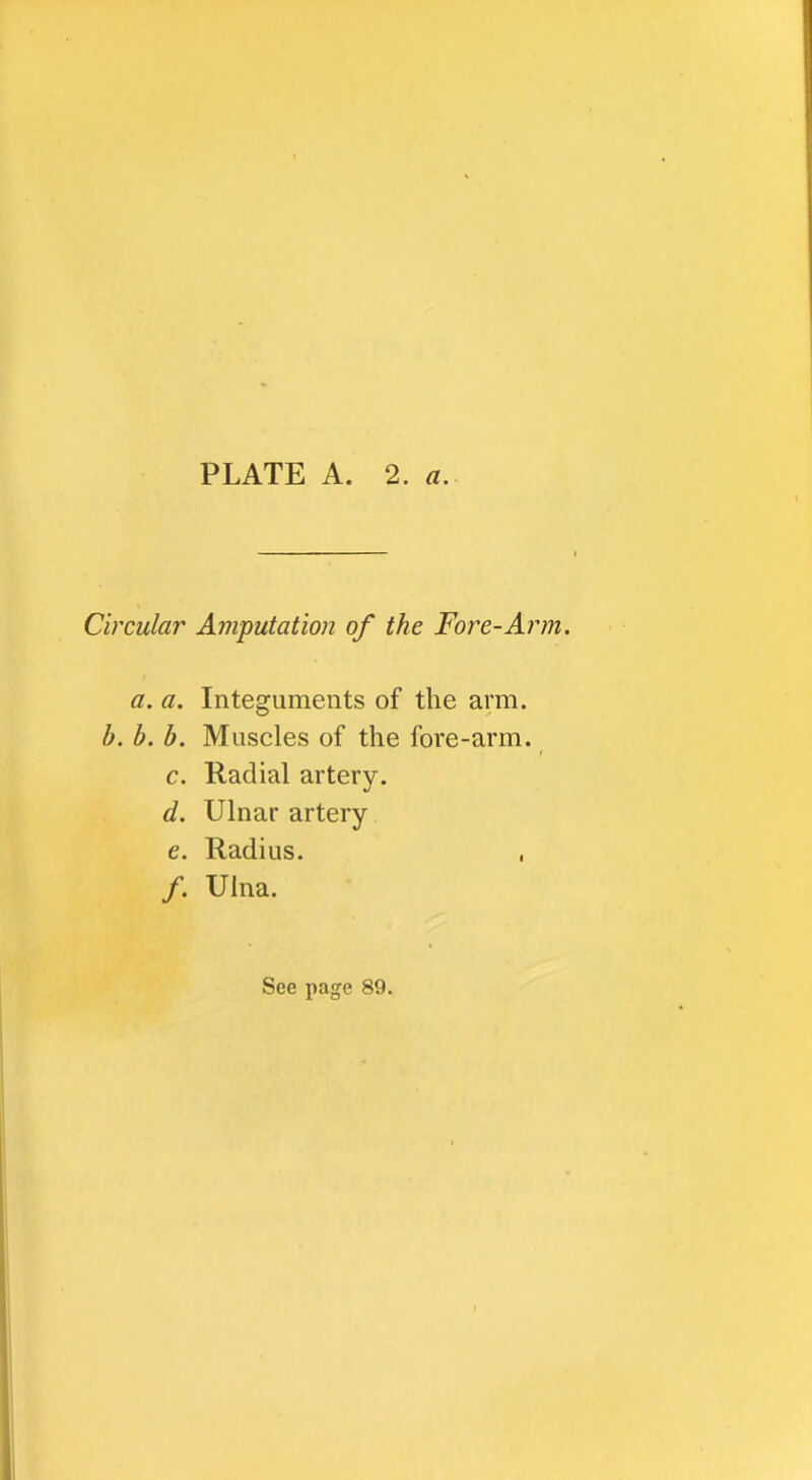 Circular Amputation of the Fore-Ai^m. a. a. Integuments of the arm. b. b. b. Muscles of the fore-arm. c. Radial artery. d. Ulnar artery e. Radius. , /. Ulna.