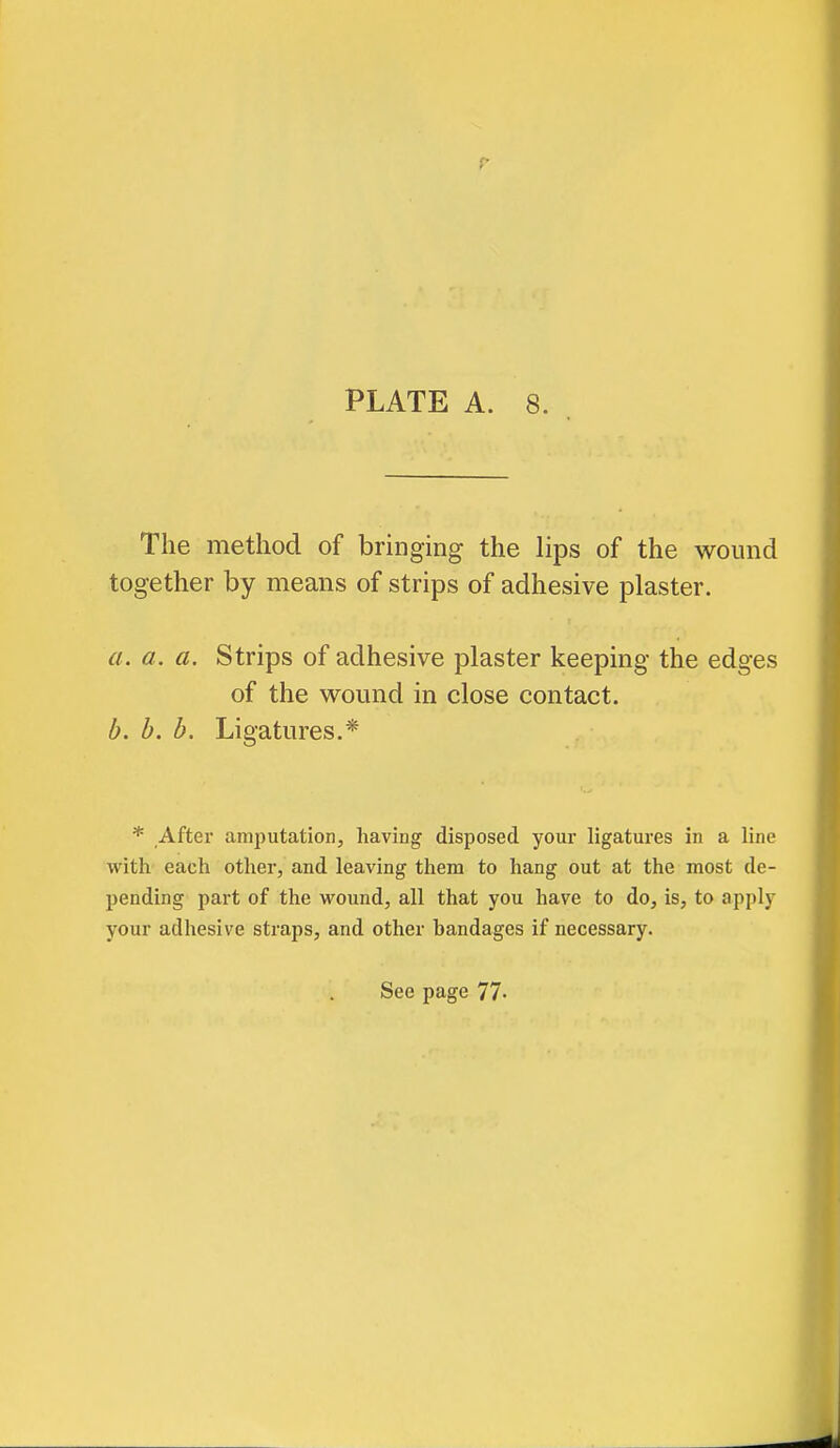 r PLATE A. 8. The method of bringing the lips of the wound together by means of strips of adhesive plaster. a. a. a. Strips of adhesive plaster keeping the edges of the wound in close contact. b, b. b. Ligatures.* * After amputation, having disposed your ligatures in a line with each other, and leaving them to hang out at the most de- pending part of the wound, all that you have to do, is, to apply your adhesive straps, and other handages if necessary.