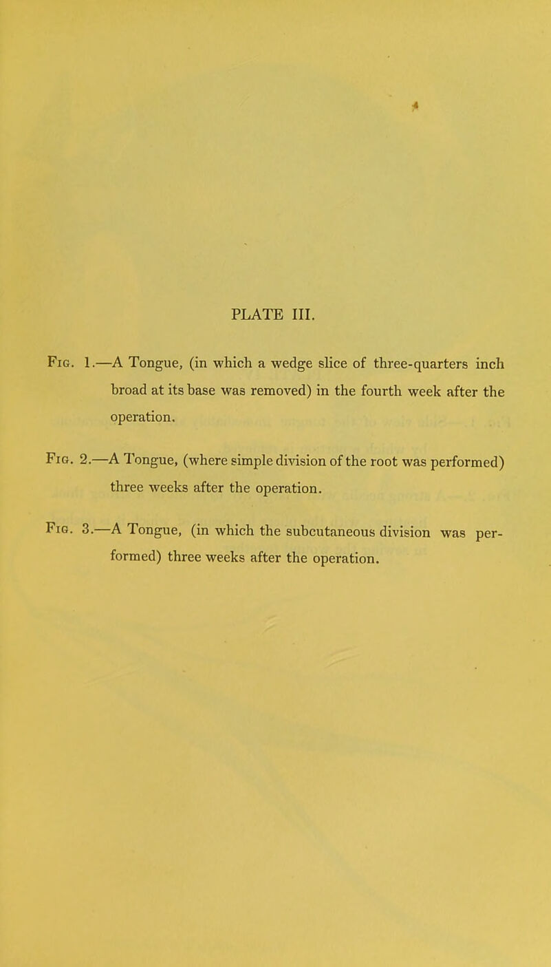 Fig. 1.—A Tongue, (in which a wedge slice of three-quarters inch broad at its base was removed) in the fourth week after the operation. Fig. 2.—A Tongue, (where simple division of the root was performed) three weeks after the operation. Fig. 3.—A Tongue, (in which the subcutaneous division was per- formed) three weeks after the operation.