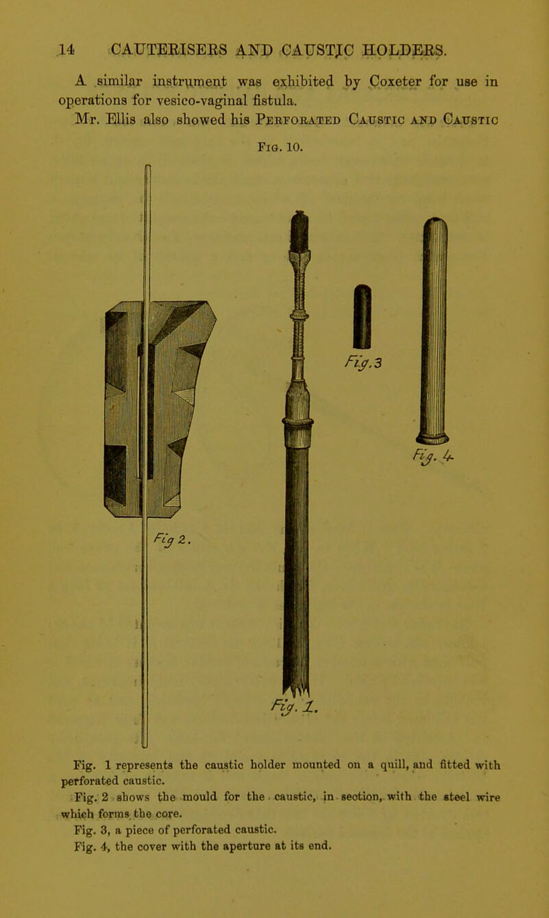 A .similar in8tr^ment was exhibited by Coxeter for use in operations for vesico-vaginal fistula. Mr. Ellis also showed his Pebfohated Caustic and Caustic Fig. 10. Fij.l. Fig. 1 represents the caustic holder mounted on a quill, and fitted with perforated caustic. Fig. 2 shows the mould for the caustic, in section, with the «teel wire which forms the core. Fig. 3, a piece of perforated caustic. Fig. 4, the cover with the aperture at its end.