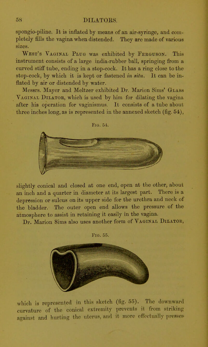 spongio-piline. It ia inflated by means of an air-syringe, and com- pletely fills the vagina when distended. They arc made of various sizes. West's Vaginal Plug was exhibited by Feegusok. This instrument consists of a large india-rubber ball, springing from a curved stifi tube, ending in a stop-cock. It has a ring close to the stop-cock, by which it is kept or fastened in situ. It can be in- flated by air or distended by water. Messrs. Mayer and Meltzer exhibited Dr. Marion Sims' Gtlass Vaginal Dilatoe, which is used by him for dilating the vagina after his operation for vaginismus. It consists of a tube about three inches long, as is represented in the annexed sketch (fig. 54), Fig. 54. slightly conical and closed at one end, open at the other, about an inch and a quarter in diameter at its largest part. There is a depression or sulcus on its upper side for the urethra and neck of the bladder. The outer open end allows the pressure of the atmosphere to assist in retaining it easily in the vagina. Dr. Marion Sims also uses another form of Vaginal Dilatok, Fia. 55. which is represented in this sketch (fig. 55). The downward curvature of the conical extremity prevents it from striking against and hurting the uterus, and it more cff'eetually prosscp