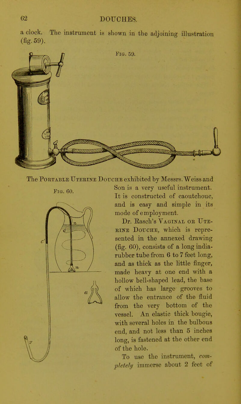 a clock. The instrument is shown in the adjoining illustration (fig. 59). The Portable Uteeine Douche exhibited by Messrs.Weiss and Son is a very useful instrument. It is constructed of caoutchouc, and is easy and simple in its mode of employment. Dr. Eascli's Vaginai, oe Ute- EiNE Douche, which is repre- sented in the annexed drawing (fig. 60), consists of a long india- rubber tube from 6 to 7 feet long, and as thick as the little finger, made heavy at one end with a hollow bell-shaped lead, the base of which has largo grooves to allow the entrance of the fluid from the very bottom of the vessel. An elastic thick bougie, with several holes in the bulbous end, and not less than 5 inches long, is fastened at the other end of the hole. To use the instrument, com- pleteJy immerse about 2 feet of