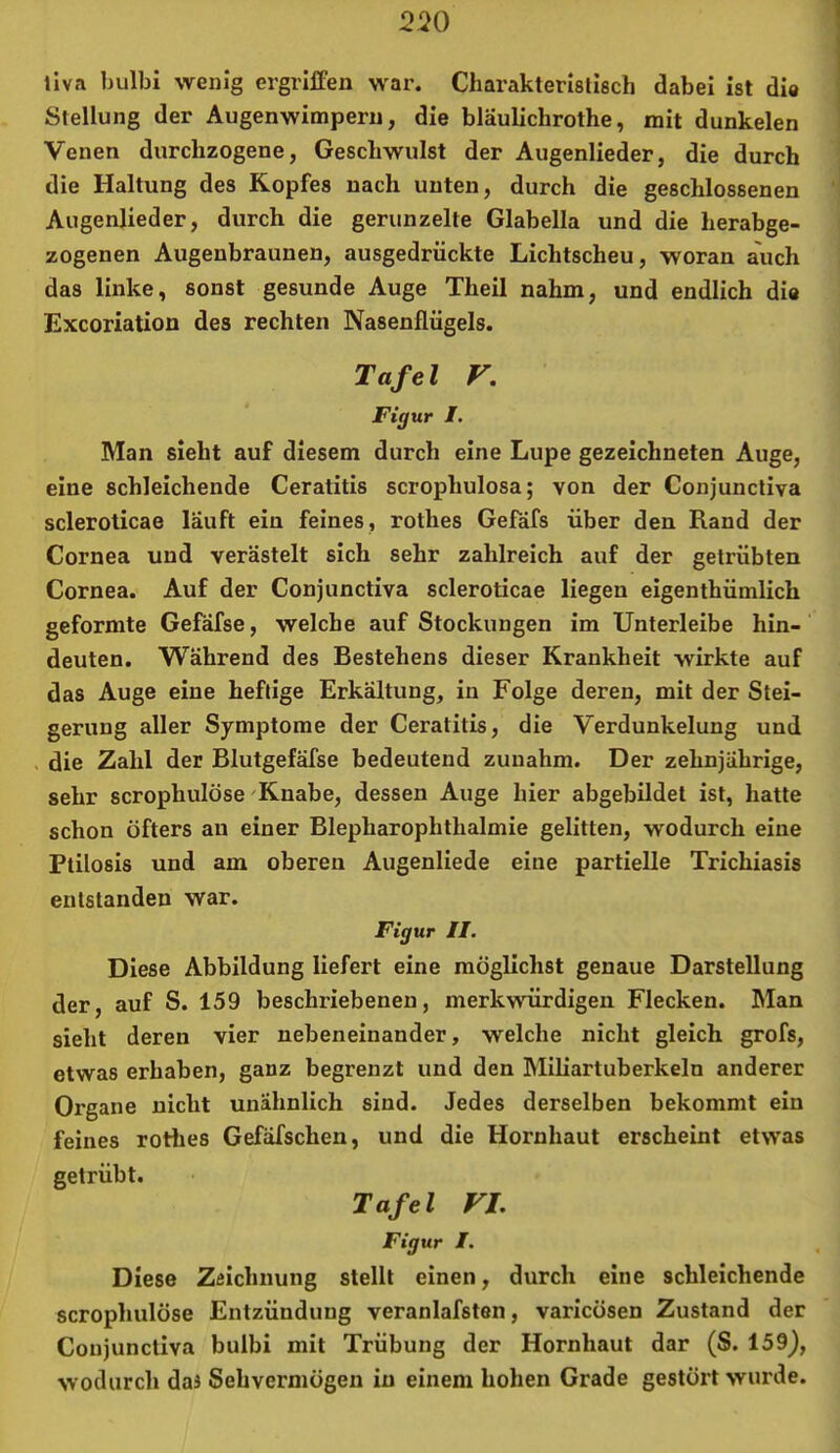2^0 llva bulbi wenig ergrilfen war. Charakteristisch dabei ist di« Stellung der Augenwimpern, die bläulichrothe, mit dunkelen Venen durchzogene, Geschwulst der Augenlieder, die durch die Haltung des Kopfes nach unten, durch die geschlossenen Augenlieder, durch die gerunzelte Glabella und die herabge- zogenen Augenbraunen, ausgedriickte Lichtscheu, woran auch das linke, sonst gesunde Auge Theil nahm, und endlich die Excoriation des rechten Nasenflügels. Tafel V. Figur /. Man sieht auf diesem durch eine Lupe gezeichneten Auge, eine schleichende Ceratitis scrophulosa; von der Conjunctiva scleroticae läuft ein feines, rothes Gefäfs über den Rand der Cornea und verästelt sich sehr zahlreich auf der getrübten Cornea. Auf der Conjunctiva scleroticae liegen eigenthümlich geformte Gefäfse, welche auf Stockungen im Unterleibe hin- deuten. Während des Bestehens dieser Krankheit wirkte auf das Auge eine heftige Erkältung, in Folge deren, mit der Stei- gerung aller Symptome der Ceratitis, die Verdunkelung und die Zahl der Blutgefäfse bedeutend zunahm. Der zehnjährige, sehr scrophulöse'Knabe, dessen Auge hier abgebildet ist, hatte schon öfters au einer Blepharophthalmie gelitten, wodurch eine Ptilosis und am oberen Augenliede eine partielle Trichiasis entstanden war. Figur II. Diese Abbildung liefert eine möglichst genaue Darstellung der, auf S. 159 beschi-iebenen, merkwürdigen Flecken. Man sieht deren vier nebeneinander, welche nicht gleich grofs, etwas erhaben, ganz begrenzt und den Miliartuberkeln anderer Organe nicht unähnlich sind. Jedes derselben bekommt ein feines rotlies Gefäfschen, und die Hornhaut erscheint etwas getrübt. Tafel FL Figur I. Diese Zeichnung stellt einen, durch eine schleichende scrophulöse Entzündung veranlafsten, varicösen Zustand der Conjunctiva bulbi mit Trübung der Hornhaut dar (S. 159), wodurch daä Sehvermögen in einem hohen Grade gestört wurde.