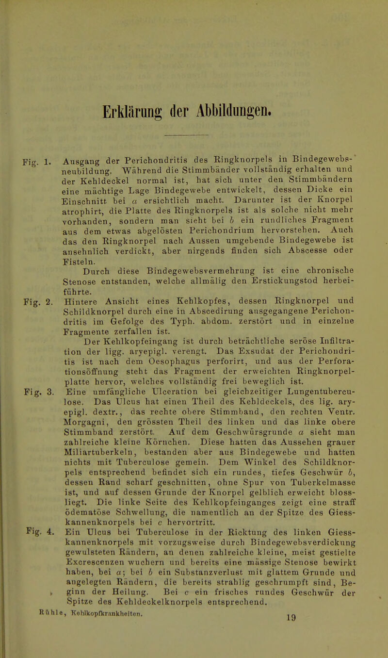 Erklärung der Abbildungen. Fi. 1. Ausgang der Perichondritis des Ringknorpels in Bindegewebs-  neubildung. Während die Stimmbänder vollständig erhalten und der Kehldeckel normal ist, hat sich unter den Stimmbändern eine mächtige Lage Bindegewebe entwickelt, dessen Dicke ein Einschnitt bei « ersichtlich macht. Darunter ist der Knorpel atrophirt, die Platte des Ringknorpels ist als solche nicht mehr vorhanden, sondern man sieht bei b ein rundliches Fragment aus dem etwas abgelösten Perichondrium hervorstehen. Auch das den Ringknorpel nach Aussen umgebende Bindegewebe ist ansehnlich verdickt, aber nirgends finden sich Abscesse oder Fisteln. Durch diese Bindegewebsvermehrung ist eine chronische Stenose entstanden, welche allmälig den Erstickungstod herbei- führte. Fig. 2. Hintere Ansicht eines Kehlkopfes, dessen Ringknorpel und Schildknorpel durch eine in Abscedirung ansgegangene Perichon- dritis im Gefolge des Typh. abdom. zerstört und in einzelne Fragmente zerfallen ist. Der Kehlkopfeingang ist durch beträchtliche seröse Infiltra- tion der ligg. aryepigl. verengt. Das Exsudat der Perichondri- tis ist nach dem Oesophagus perforirt, und aus der Perfora- tionsöfi^nung steht das Fragment der erweichten Ringknorpel- platte hervor, welches vollständig frei beweglich ist. Fig. 3. Eine umfängliche Ulceration bei gleichzeitiger Lungentubercu- lose. Das Ulcus hat einen Theil des Kehldeckels, des lig. ary- epigl. dextr., das rechte obere Stimmband, den rechten Ventr. Morgagni, den grössten Theil des linken und das linke obere Stimmband zerstört. Auf dem Geschwürsgrunde a sieht man zahlreiche kleine Körnchen. Diese hatten das Aussehen grauer Miliartuberkeln, bestanden aber aus Bindegewebe und hatten nichts mit Tuberculose gemein. Dem Winkel des Schildknor- pels entsprechend befindet sich ein rundes, tiefes Geschwür b, dessen Rand scharf geschnitten, ohne Spur von Tuberkelmasse ist, und auf dessen Grunde der Knorpel gelblich erweicht bloss- liegt. Die linke Seite des Kehlkopfeinganges zeigt eine straff ödematöse Schwellung, die namentlich an der Spitze des Giess- kannenknorpels bei c hervortritt. Fig. 4. Ein Ulcus bei Tuberculose in der Ricktung des linken Gless- kannenknorpels mit vorzugsweise durch Bindegewebsverdickung gewulsteten Rändern, an denen zahlreiche kleine, meist gestielte Excrescenzen wuchern und bereits eine mässige Stenose bewirkt haben, bei a; bei b ein Substanzverlust mit glattem Grunde und angelegten Rändern, die bereits strahlig geschrumpft sind, Be- , ginn der Heilung. Bei c ein frisches rundes Geschwür der Spitze des Kehldeckelknorpels entsprechend. Rühle, Kehlkoptkrnnkhalten. jg