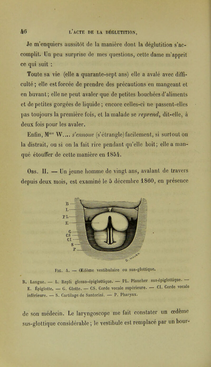 Je m'enquiers aussitôt de la manière dont la déglutition s'ac- complit. Un peu surprise de mes questions, cette dame m'apprit ce qui suit : Toute sa vie (elle a quarante-sept ans) elle a avalé avec diffi- culté ; elle est forcée de prendre des précautions en mangeant et en buvant; elle ne peut avaler que de petites bouchées d'aliments et de petites gorgées de liquide; encore celles-ci ne passent-elles pas toujours la première fois, et la malade se reprend, dit-elle, à deux fois pour les avaler. Enfin, M^ W.... s'ennoue (s'étrangle)facilement, si surfout on la distrait, ou si on la fait rire pendant qu'elle boit; elle a man- qué étouffer de cette manière en 185/i. Obs. II. — Un jeune homme de vingt ans, avalant de travers depuis deux mois, est examiné le 5 décembre 1860, en présence FiG. h. — (Edème vestibulaire ou sus-glottique. B. Langue. — L. Repli glosso-épiglotlique. — PL. Plancher sus-épiglottique. — E. Épiglotte. — G. Glotte. — CS. Corde vocale supérieure. — CI. Corde vocale inférieure. — S. Cartilage de Santorini. — P. Pharynx. de son médecin. Le laryngoscope me fait constater un œdème sus-glottique considérable ; le vestibule est remplacé par un bour-