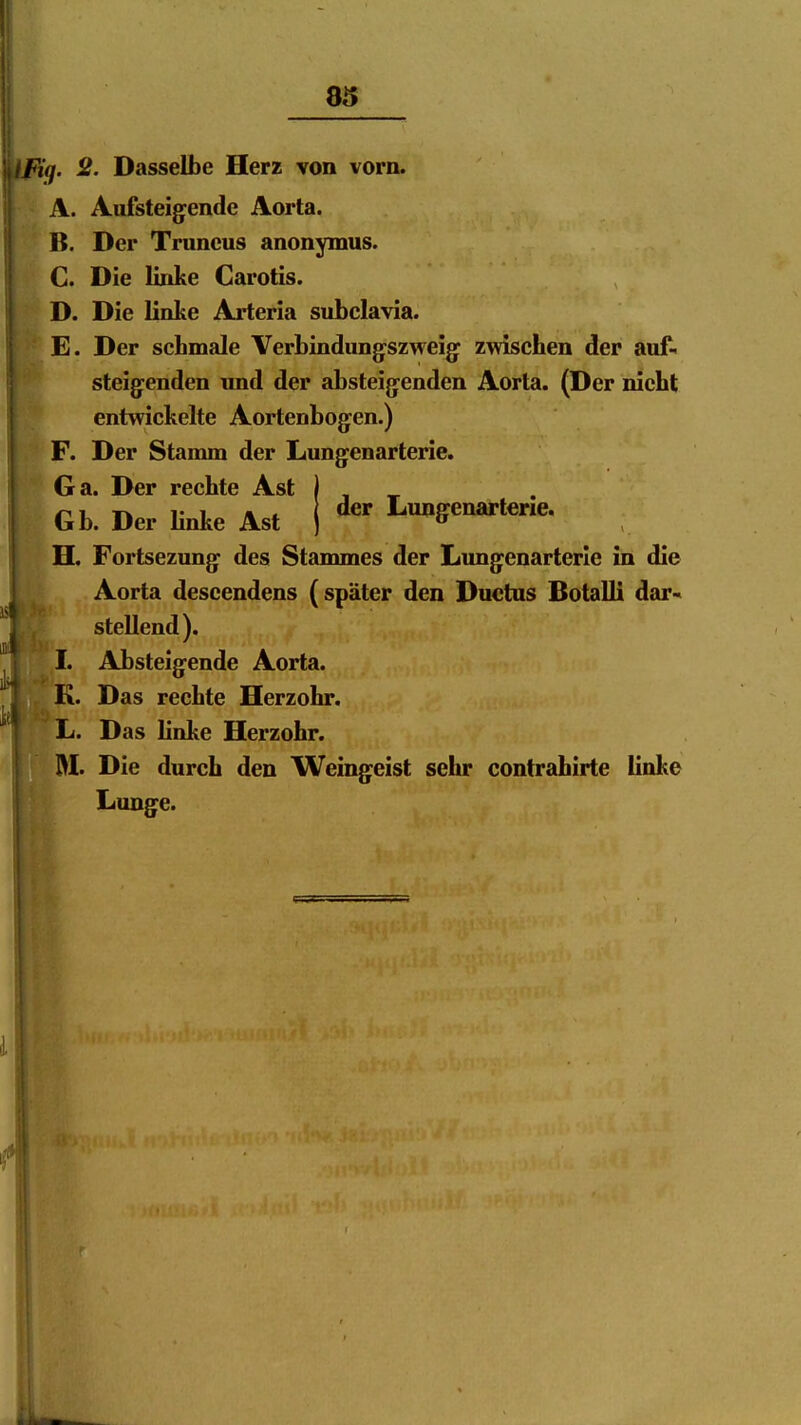 IfFig. i?. Dasselbe Herz von vorn. A. Aufsteigende Aorta. B. Der Truncus anonymus. C. Die linke Carotis. D. Die linke Arteria subclavia. E. Der schmale Verbindung-szweig zwischen der auf., steigenden und der absteigenden Aorta. (Der nicht entwickelte Aortenbogen.) F. Der Stamm der Lungenarterie. Ga. Der rechte Ast Gb. Der Hnke Ast Lungenartene. H. Fortsezung des Stammes der Lungenarterie in die Aorta descendens (später den Ductus Botalli dar» stellend). L Absteigende Aorta. K. Das rechte Herzohr. L. Das linke Herzohr. M. Die durch den Weingeist sehr contrahirte linke Lunge.