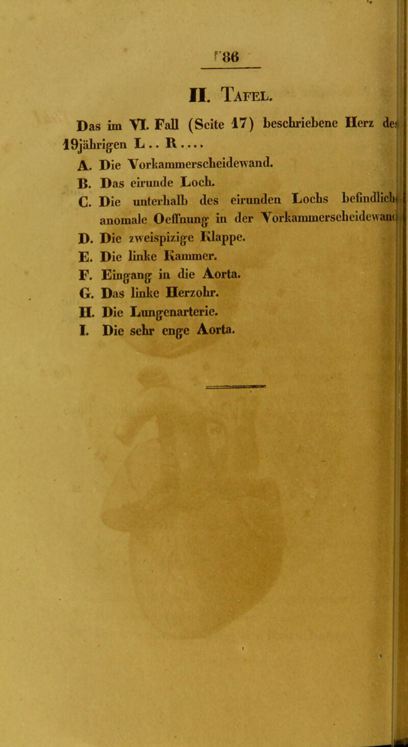 r86 II. Tafel. Das im VI. Fall (Seite 17) beschriebene Herz de^ 19jälirigen L .. R .... A. Die VorkammerscLeidewand. B. Das eirunde Loch. C. Die unterhalb des eirunden Lochs befindlich« anomale Oeffnung: in der Vorkanunerscheidcwanii D. Die zweispizig^e Klappe. E. Die linke Kammer. F. Eingrangp in die Aorta. G. Das linke Herzohr. H. Die Lungenarterie. I. Die sehr enge Aorta.