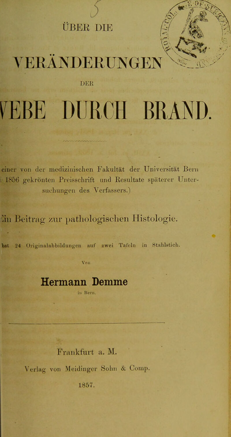 UBER DIE /(^ YERANDERUNGEN DEK fEBE DURCH BRAND. einer von der medizinischen Fakultät der Universität Bern 1S56 gekrönten Preisschrift und Resultate späterer Unter- suchung-en des Verfassers.) 'in Beitrag zur pathologisclien Histologie. bst 24 Oiiginalabbildungeii auf zwei Tafdn in Stahlstich. Von Hermann Demme in Hern. Frankfurt a. M. Verlag von Meidinger Sohn & Comp. 1857.