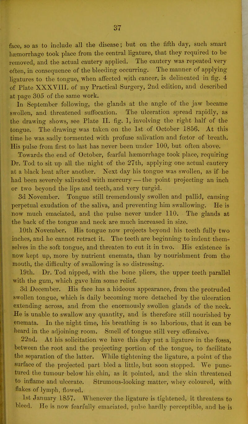 face, so as to include all the disease; but on the fifth day, such smart hajmorrhage took place from the central ligature, that they required to be removed, and the actual cautery applied. The cautery was repeated very often, in consequence of the bleeding occurring. The manner of applying ligatures to the tongue, when affected with cancer, is delineated in fig. 4 of Plate XXXVIII. of my Practical Surgery, 2nd edition, and described at page 305 of the same work. In September following, the glands at the angle of the jaw became swollen, and threatened suffocation. The ulceration spread rapidly, as the drawing shows, see Plate II. fig. 1, involving the riglit half of the tongue. The drawing was taken on the 1st of October 1856. At this time he was sadly tormented with profuse salivation and fcetor of breath. His pulse from first to last has never been under 100, but often above. Towards the end of October, fearful haemorrhage took place, requiring Dr. Tod to sit up all the night of the 27th, applying one actual cautery at a black heat after another. Next day his tongue was swollen, as if he had been severely salivated with mercury — the point projecting an inch or two beyond the lips and teeth,, and very turgid. 3d November. Tongue still tremendously swollen and pallid, causing perpetual exudation of the saliva, and preventing him swallowing. He is now much emaciated, and the pulse never under 110. The glands at the back of the tongue and neck are much increased in size. 10th November. His tongue now projects beyond his teeth fully two inches, and he cannot retract it. The teeth are beginning to indent them.- selves in the soft tongue, and threaten to cut it in two. His existence is now kept up, more by nutrient enemata, than by nourishment from the mouth, the difficulty of swallowing is so distressing. 19th. Dr. Tod nipped, with the bone pliers, the upper teeth parallel with the gum, which gave him some relief. 3d December. His face has a hideous appearance, from the protruded swollen tongue, wliich is daily becoming more detached by the ulceration extending across, and from the enormously swollen glands of the neck. He is unable to swallow any quantity, and is therefore still nourished by enemata. In the night time, his breatiiing is so laborious, that it can be heard in the adjoining room. Smell of tongue still very offensive. 22nd. At his solicitation we have this day put a ligature in the fossa, between the root and the projecting portion of the tongue, to facilitate the separation of the latter. While tightening the ligature, a point of the surface of the projected part bled a little, but soon stopped. We punc- tured the tumour below his chin, as it pointed, and the skin threatened to inflame and ulcerate. Strumous-looking matter, whey coloured, with flakes of lymph, flowed. 1st January 1857. Whenever the ligature is tightened, it threatens to bleed. He is now fearfully emaciated, pulse hardly perceptible, and he is