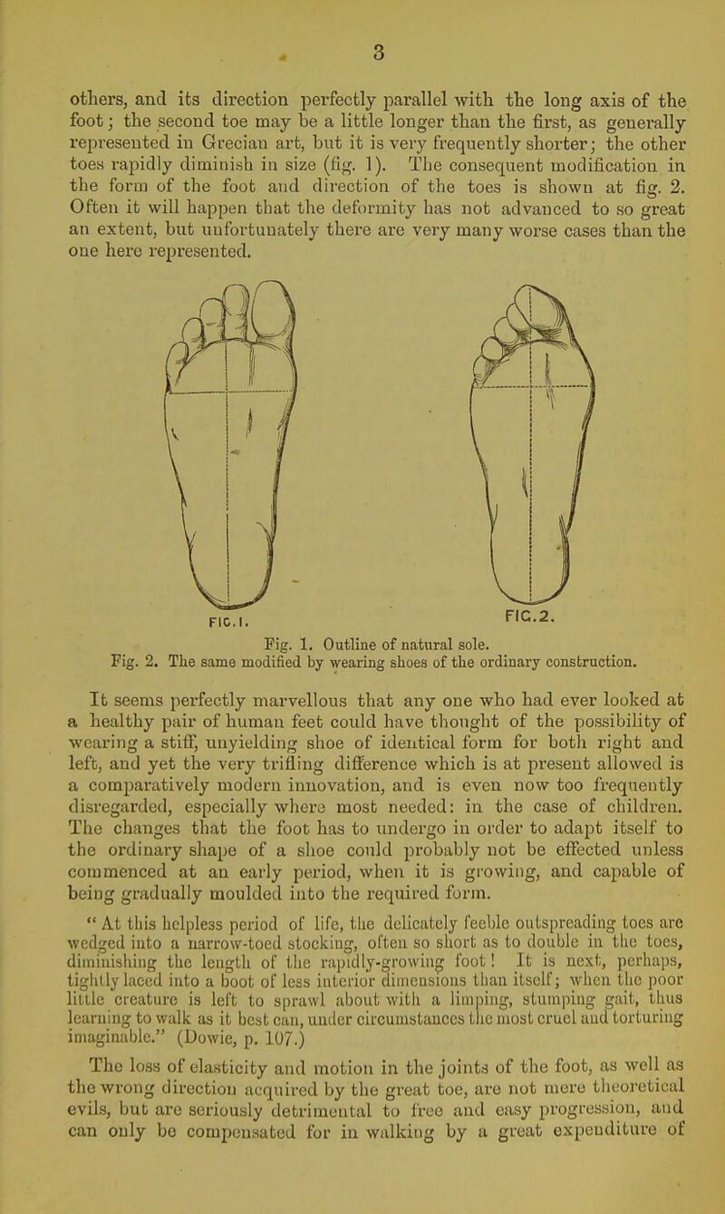 others, and its direction perfectly parallel with the long axis of the foot; the second toe may be a little longer than the first, as generally represented in Grecian art, but it is very frequently shorter; the other toes rapidly diminish in size (fig. 1). The consequent modification in the form of the foot and direction of the toes is shown at fig. 2. Often it will happen that the defi)rmity has not advanced to so great an extent, but unfortunately there are very many worse cases than the one here represented. 3/ \ T iv J / 1 FIC.I. FIC.2. Fig. 1. Outline of natural sole. Fig. 2. The same modified by wearing shoes of tlie ordinary construction. It seems perfectly marvellous that any one who had ever looked at a healthy pair of human feet could have thought of the possibility of wcax'ing a stitf, unyielding shoe of identical form for both right and left, and yet the very trifling difference which is at present allowed is a comparatively modern innovation, and is even now too frequently disregarded, especially where most needed: iu the case of children. The changes that the foot has to undergo in order to adapt itself to the ordinary shape of a slioe could probably not be effected unless commenced at an early period, when it is growing, and capable of being gradually moulded into the required form.  At tiiis helpless period of life, the delicately feeble outspreading toes arc wedged into a uarrow-tocd stoclciug, often so short as to double iu the toes, dimiuisiiing the length of the riipidly-growing i'oot! It is next, perhaps, tightly laced into a boot of less interior dimensions than itself; when the poor lilllc creature is left to sprawl about with a linining, stumping gait, thus learning to walk as it best can, under circuuistauccs the most cruel and torturing imaginable. (Dowie, p. 107.) The loHn of elasticity and motion in the joints of the foot, as well as the wrong direction acquired by the great toe, are not mere tlieoretical evils, but are seriously detrimental to free and easy progression, and can only bo compensated for in walking by a great expenditure of