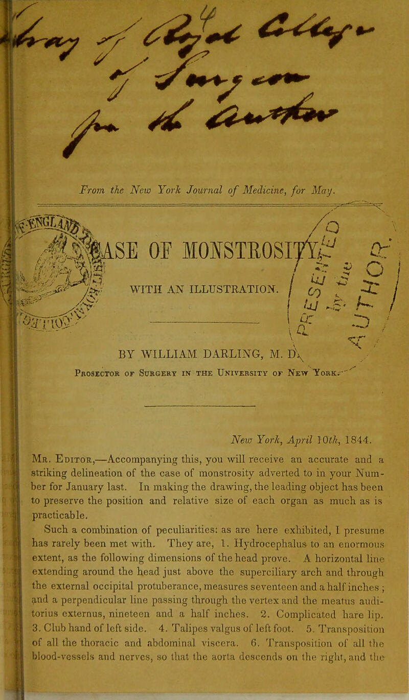 From the New York Journal of Medicine, for May. ' /^IliSE OF MOISTEOSIJT^ 0:' WITH AN ILLUSTRATION. I 00 . a BY WILLIAM DARLING, M. D\ Prosector or Surgery in the University or New York.-' New York, April lOik, 1844. Mr. Editor,—Accompanying this, you will receive an accurate and a striking delineation of the case of monstrosity adverted to in your Num- ber for January last. In making the drawing, the leading object has been to preserve the position and relative size of each organ as much as is practicable. Such a combination of peculiarities: as are here exhibited, I presume has rarely been met with. They are, 1. Hydrocephalus to an enormous extent, as the following dimensions of the head prove. A horizontal line extending around the head just above the superciliary arch and througti the external occipital protuberance, measures seventeen and a half inches ; and a perpendicular line passing through the vertex and the meatus audi- torius cxternus, nineteen and a half inches. 2. Complicated hare lip. 3. Club hand of left side. 4. Talipes valgus of left foot. 5. Transpo-sition of all the thoracic and abdominal viscera. 6. Transposition of all the blood-vessels and nerves, so that the aorta descends on the right, and tlic