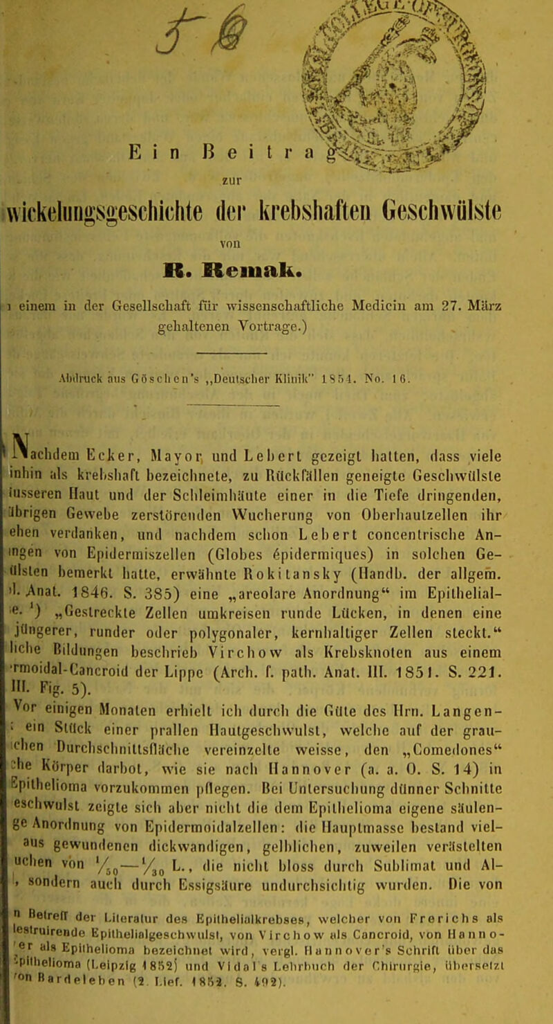 zur wickeluno'sgescliichte der krebshafteu Geschwülste von B. Reiiiak. 1 einem in der Gesellschaft für wissenschaftliche Medicin am 27. März gehaltenen Vortrage.) Abdruck aiis Göschcn's „Deutscher Klinik 1S54. No. 16. iladulem Ecker, Mayor und Leberl gezeigt halten, dass viele inhin ids krelishafl bezeichnete, zu Rückfällen geneigte Geschwülste iiisseren Haut und der Sclileimhyute einer in die Tiefe dringenden, iJbrigen Gewebe zerstörenden Wucherung von Oherhaulzellen ihr eben verdanken, und nachdem sciion Lebert concentrische An- ingen von Epidermiszellen (Glohes 6pidermiques) in solcben Ge- ülslen bemerkt batte, erwähnte Roki tansky (Handb. der ailgem. 'I. .Anat. 1846. S. 385) eine „areolare Anordnung im Epilbelial- 'S- ) „Gestreckte Zellen umkreisen runde Lücken, in denen eine jüngerer, runder oder polygonaler, kernhaltiger Zellen steckt. Iiclie Bildungen beschrieb Virchow als Krebsknolen aus einem ■mioidal-Cancroid der Lippe (Arch. f. path. Anat. IIL 1851. S. 221. III. Fig. 5). Vor einigen Monaten erhielt ich durch die Güte des Hrn. Langen- ' ein Stück einer prallen Hautgeschwulsl, welche auf der grau- t'ben DurcbschniltsflUche vereinzelte weisse, den „Comedones ^'he Körper darbot, wie sie nacli Hannover (a. a. 0. S. 14) in Epilbelioma vorzukommen pflegen. Bei Unlersucbung dünner Schnitte escbwulsl zeigte sich aber niciit die dem Epithelioma eigene süulcn- gc Anordnung von Epidermoidalzellen: die Hauptmasse bestand Viel- aus gewundenen dickwandigen, gelblichen, zuweilen verilstelten uclien von y.^^~y^^ L, die nicht bloss durch Sublimat und Al- . sondern aucb durch Essigsäure undurchsichtig wurden. Die von n Belrefl der Liloralur des Epilheiialkrebses, welcher von Frorichs als lestruirende Epiihelinlgeschwulsl, von Virchow mIs Concrold, von Ho nno- er als Epiihelioma bezeichnet wird, vergl. Hannover'» Schrift über das •pilhelloma (Leipzig 1852) und Vldal's Lehrbuch der Chiriirsie, übersetzt 'on Bardeleben (2 LIeL 4853. S. 402).