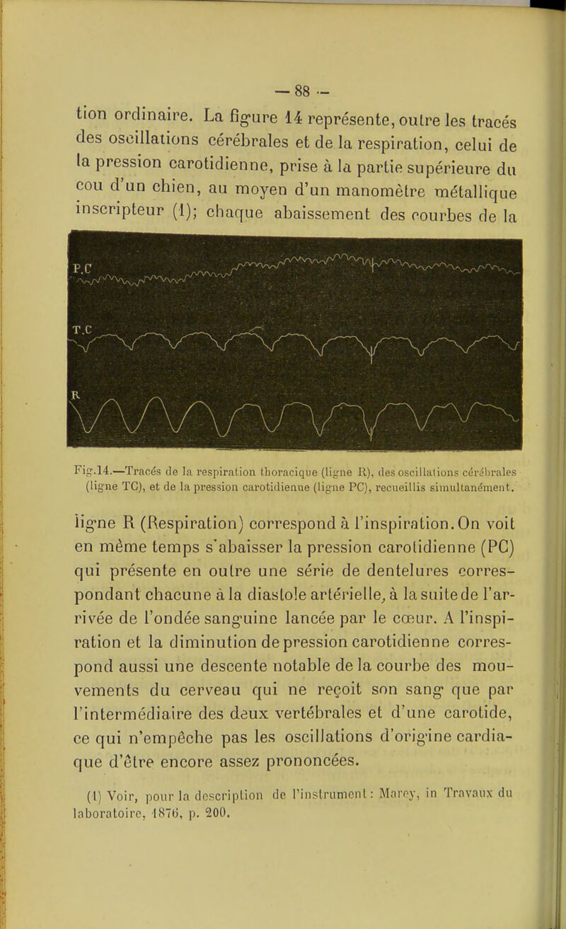 tion ordinaire. La fig-ure 14 représente, oulre les tracés des oscillaiions cérébrales et de la respiration, celui de la pression carotidienne, prise à la partie supérieure du cou d'un chien, au moyen d'un manomèlre métallique inscripteur (1); chaque abaissement des courbes de la Fi_q'.14.—Tracés de la respiration thoracique (liirne R), des oscillations cérâbrales (ligne TC), et de la pression carotidienvae (ligne PC), recueillis simultanément. lig-ne R (Respiration) correspond à l'inspiration. On voit en même temps s'abaisser la pression carotidienne (PC) qui présente en oulre une série de dentelures corres- pondant chacune à la diastole artérielle^ à la suite de l'ar- rivée de l'ondée sang-uinc lancée par le cœur. A l'inspi- ration et la diminution dépression carotidienne corres- pond aussi une descente notable de la courbe des mou- vements du cerveau qui ne reçoit son sang* que par l'intermédiaire des deux vertébrales et d'une carotide, ce qui n'empêche pas les oscillations d'orig'ine cardia- que d'être encore assez prononcées. (l) Voir, pour la descriplion de rinslrumcnl: Maroy, in Travaux du laboratoire, 187(3, p. 200.