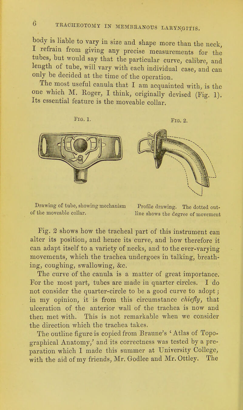 body is liable to vary in size and shape more than the neck, I refrain from giving any precise measurements for the tubes, but would say that the particular curve, calibre, and length of tube, will vary with each individual case, and can only be decided at the time of the operation. The most useful canula that I am acquainted with, is the one which M. Roger, I think, originally devised (Fig. 1). Its essential feature is the moveable collar. Pig. i. Fig. 2. Drawing of tube, showing mechanism of the moveable collar. Profile drawing. The dotted out- line shows the degree of movement Fig. 2 shows how the tracheal part of this instrument can alter its position, and hence its curve, and how therefore it can adapt itself to a variety of necks, and to the ever-varying movements, which the trachea undergoes in talking, breath- ing, coughing, swallowing, &c. The curve of the canula is a matter of great importance. For the most part, tubes are made in quarter circles. I do not consider the quarter-circle to be a good curve to adopt; in my opinion, it is from this circumstance chiefly, that ulceration of the anterior wall of the trachea is now and then met with. This is not remarkable when we consider the direction which the trachea takes. The outline figure is copied from Braune's 1 Atlas of Topo- graphical Anatomy/ and its correctness was tested by a pre- paration which I made this summer at University College, with the aid of my friends, Mr. Godlee and Mr. Ottley. The