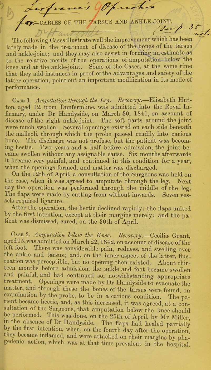 I -^4»:^CARIES OF THE TARSUS AND ANKLE-JOINT. ^ ^ / // ^ / /.t:U^ /■ ^-^ , The following Cases illustrate well the improvement which has been lately made in the treatment of disease of the bones of the tarsus and ankle-joint; and they may also assist in forming an estimate as to the relative merits of the operations of amputation below the knee and at the ankle-joint. Some of the Cases, at the same time that they add instances in proof of the advantages and safety of the latter operation, point out an important modification in its mode of performance. Case 1. Amputation through the Leg. Becomry.—Elisabeth Hut- ton, aged 12, from Dunfermline, was admitted into the Royal In- firmary, under Dr Handyside, on March SO, 1841, on account of disease of the right ankle-joint. The soft parts around the joint were much swollen. Several openings existed on each side beneath the malleoli, through which the probe passed readily into carious bone. The discharge was not profuse, but the patient was becom- ing hectic. Two years and a half before admission, the joint be- came swollen without any assignable cause. Six months afterwards it became very painful, and continued in this condition for a year, when the openings formed, and matter was discharged. On the 12th of April, a consultation of the Surgeons was held on the case, when it was agreed to amputate through the leg. Next day the operation was performed through the middle of the leg. The flaps were made by cutting from without inwards. Seven ves- sels required ligature. After the operation, the hectic declined rapidly; the flaps united by the first intention, except at their margins merely; and the pa- tient was dismissed, cured, on the 30th of April. Case 2. Amputation helow the Knee. Recovery.—Cecilia Grant, aged 15, was admitted on March 22,1842, on account of disease of the left foot. There was considerable pain, redness, and swelling over the ankle and tarsus; and, on the inner aspect of the latter, fluc- tuation was perceptible, but no opening then existed. About thir- teen months before admission, the ankle and foot became swollen and painful, and had continued so, notwithstanding appropriate treatment. Openings were made by Dr Handyside to evacuate the matter, and through these the bones of the tarsus were found, on examination by the probe, to be in a carious condition. The'pa- tient became hectic, and, as this increased, it was agreed, at a con- sultation of the Surgeons, that amputation below the knee should be performed. This was done, on the 25th of April, by Mr Miller in the absence of Dr Handyside. The flaps had healed partially by the hrst intention, when, on the fourth day after the operation they became inflamed, and were attacked on their margins by pha- gedemc action, which was at that time prevalent in the hospital