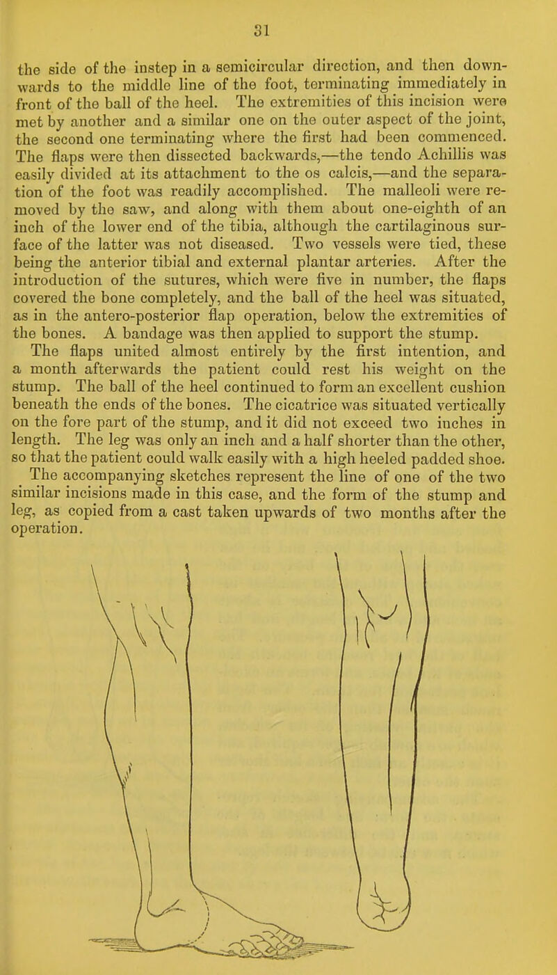 the side of the instep in a semicircular direction, and then down- wards to the middle line of the foot, terminating immediately in front of the ball of the heel. The extremities of this incision wero met by another and a similar one on the outer aspect of the joint, the second one terminating where the first had been commenced. The flaps were then dissected backwards,—the tendo Achillis was easily divided at its attachment to the os calcis,—and the separa- tion of the foot was readily accomplished. The malleoli were re- moved by the saw, and along with them about one-eighth of an inch of the lower end of the tibia, although the cartilaginous sur- face of the latter was not diseased. Two vessels were tied, these being the anterior tibial and external plantar arteries. After the introduction of the sutures, which were five in number, the flaps covered the bone completely, and the ball of the heel was situated, as in the antero-posterior flap operation, below the extremities of the bones. A bandage was then applied to support the stump. The flaps united almost entirely by the first intention, and a month afterwards the patient could rest his weight on the stump. The ball of the heel continued to form an excellent cushion beneath the ends of the bones. The cicatrice was situated vertically on the fore part of the stump, and it did not exceed two inches in length. The leg was only an inch and a half shorter than the other, so that the patient could walk easily with a high heeled padded shoe. The accompanying sketches represent the line of one of the two similar incisions made in this case, and the form of the stump and leg, as copied from a cast taken upwards of two months after the operation.