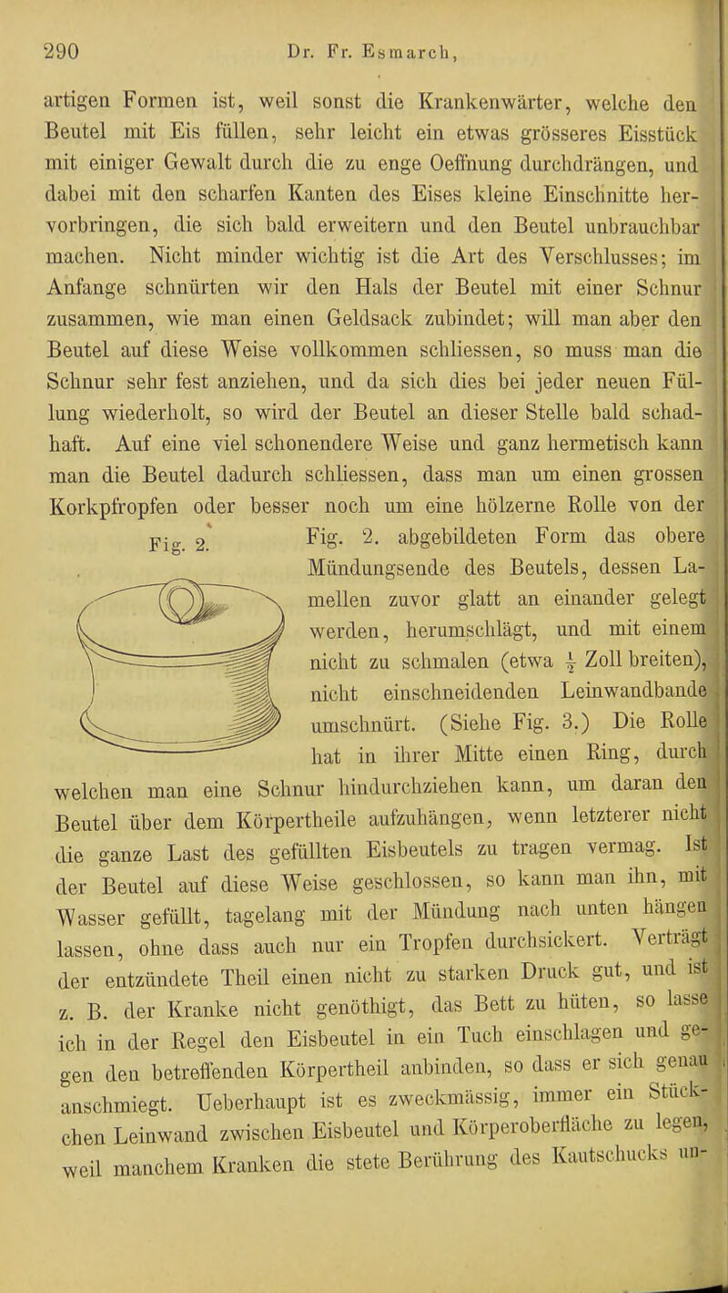 artigen Formen ist, weil sonst die Krankenwärter, welche den Beutel mit Eis füllen, sehr leicht ein etwas grösseres Eisstück mit einiger Gewalt durch die zu enge Oefihung durchdrängen, und dabei mit den scharten Kanten des Eises kleine Einschnitte her- vorbringen, die sich bald erweitern und den Beutel unbrauchbar machen. Nicht minder wichtig ist die Art des Verschlusses; im Anfange schnürten wir den Hals der Beutel mit einer Schnur zusammen, wie man einen Geldsack zubindet; will man aber den Beutel auf diese Weise vollkommen schliessen, so muss man die Schnur sehr fest anziehen, und da sich dies bei jeder neuen Fül- lung wiederholt, so wird der Beutel an dieser Stelle bald schad- haft. Auf eine viel schonendere Weise und ganz hermetisch kann man die Beutel dadurch schliessen, dass man um einen grossen Korkpfropfen oder besser noch um eine hölzerne Rolle von der pj„ 2.' Fi»- abgebildeten Form das obere Mündungsende des Beutels, dessen La- mellen zuvor glatt an einander gelegt werden, herumschlägt, und mit einem nicht zu schmalen (etwa | Zoll breiten), nicht einschneidenden Leinwandbande umschnürt. (Siehe Fig. 3.) Die Rolle hat in ihrer Mitte einen Ring, durch welchen man eine Schnur hindurchziehen kann, um daran den Beutel über dem Körpertheile aufzuhängen, wenn letzterer nicht die ganze Last des gefüllten Eisbeutels zu tragen vermag. Ist der Beutel auf diese Weise geschlossen, so kann man ihn, mit Wasser gefüllt, tagelang mit der Mündung nach unten hängen lassen, ohne dass auch nur ein Tropfen durchsickert. Verträgt der entzündete Theil einen nicht zu starken Druck gut, und ist z. B. der Kranke nicht genöthigt, das Bett zu hüten, so lasse ich in der Regel den Eisbeutel in ein Tuch einschlagen und ge- gen den betreffenden Körpertheil anbinden, so dass er sich genau anschmiegt. Ueberhaupt ist es zweckmässig, immer ein Stück- chen Leinwand zwischen Eisbeutel und Körperoberttäche zu legen, weil manchem Kranken die stete Berülirung des Kautschucks un-