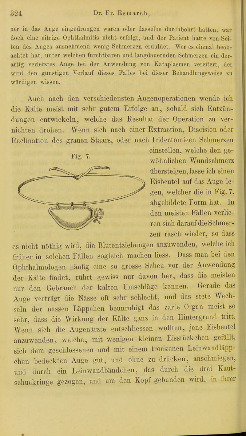ner in das Auge eingedrungen waren oder dasselbe durchbohrt hatten, war doch eine eitrige Ophthalmitis nicht erfolgt, und der Patient hatte von Sei- ten des Auges ausnehmend wenig Schmerzen erduldet. Wer es einmal beob- achtet hat, unter welchen furchtbaren und langdauernden Schmerzen ein der- artig verletztes Auge bei der Anwendung von Kataplasmen vereitert, der wird den günstigen Verlauf dieses Falles bei dieser Behandlungsweise zu würdigen wissen. Auch nach den verschiedensten Augenoperationen wende ich die Kälte meist mit sehr gutem Erfolge an, sobald sich Entzün- dungen entwickeln, welche das Resultat der Operation zu ver- nichten drohen. Wenn sich nach einer Extraction, Discision oder Reclination des grauen Staars, oder nach Iridectomieen Schmerzen es nicht nöthig wird, die Blutentziehungen anzuwenden, welche ich früher in solchen Fällen sogleich machen Hess. Dass man bei den Ophthalmologen häufig eine so grosse Scheu vor der Anwendung der Kälte findet, rührt gewiss nur davon her, dass die meisten nur den Gebrauch der kalten Umschläge kennen. Gerade das Auge verträgt die Nässe oft sehr schlecht, und das stete Wecli- seln der nassen Läppchen beunruhigt das zarte Organ meist so sehr, dass die Wirkung der Kälte ganz in den Hintergrund tritt. Wenn sich die Augenärzte entschliessen wollten, jene Eisbeutel anzuwenden, welche, mit wenigen kleinen Eisstückchen gefüllt, sich dem geschlossenen und mit einem trockenen Leinwandläpp- chen bedeckten Auge gut, und ohne zu drücken, anschmiegen, und durch ein Leinwandbändchen, das durch die drei Kaut- schuckringe gezogen, und um den Kopf gebunden wird, in ihrer Fig. 7. einstellen, welche den ge- wöhnlichen Wundschmerz übersteigen, lasse ich einen Eisbeutel auf das Auge le- gen, welcher die in Fig. 7. abgebildete Form hat. In den meisten Fällen verlie- ren sich darauf die Schmer- zen rasch wieder, so dass