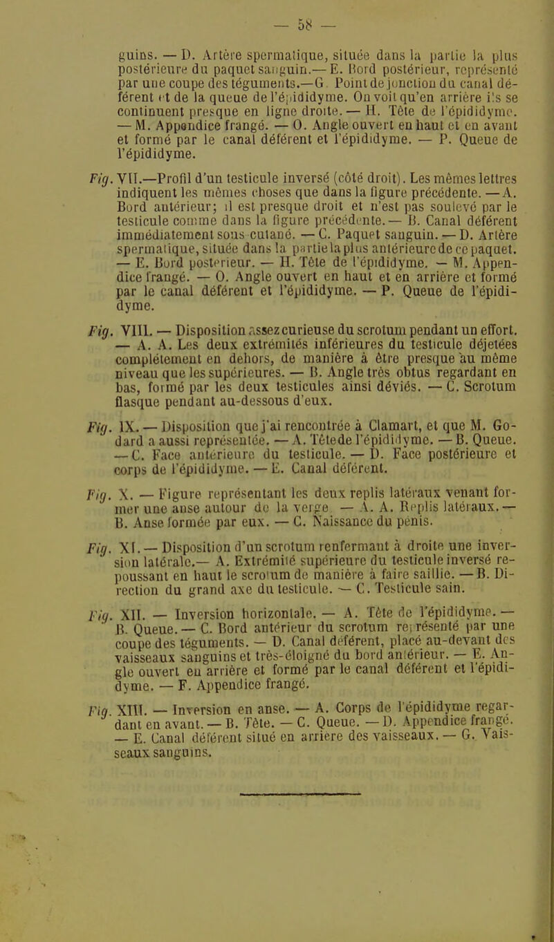 — 58 — guins.—D. Artère sperrnaîique, située dans la partie la plus postérieure du paquet sanguin.— E. Hord postérieur, représenté par une coupe des téguments.—G Point de jonction du canal dé- férent et de la queue de l'éjtididyme. On voit qu'en arrière i'.s se continuent presque en ligne droite. — H. Tète de l'épididyme. — M. Appendice frangé. — 0. Angle ouvert en haut et en avant et formé par le canal déférent et l'épididyme. — P. Queue de l'épididyme. Fig. VU.—Profil d'un testicule inversé (côté droit). Les mêmes lettres indiquent les mêmes choses que dans la figure précédente. —A. Bord autérieur; il est presque droit et n'est pas soulevé par le testicule comme dans la figure précédante. — B. Canal déférent immédiatement sous cutané. —C. Paqupt sauguin. — D. Artère sperrnaî ique, située dans la partie la plus antérieure de ce paquet. — E. Bord postérieur. — H. Tète de l'épididyme. — M. Appen- dice frangé. — 0. Angle ouvert en haut et en arrière et formé par le canal déférent et l'épididyme. — P. Queue de l'épidi- dyme. Fig. VIII. — Disposition Assez curieuse du scrotum pendant un effort. — A. A. Les deux extrémités inférieures du testicule déjetées complètement en dehors, de manière à être presque au même niveau que les supérieures. — B. Angle très obtus regardant en bas, formé par les deux testicules ainsi déviés. —C. Scrotum flasque pendant au-dessous d'eux. Fig. IX. — Disposition que j'ai rencontrée à Clamart, et que M. Go- dard a aussi représentée. —A.Tètede l'épidhlyme. —B. Queue. — C. Face antérieure du testicule. — I). Face postérieure et corps de l'épididyme. — E. Canal déférent. fia. X. — Figure représentant les deux replis latéraux venant for- mer une ause autour do la verge — A. A. Replis latéraux.— B. Anse formée par eux. — C. Naissance du pénis. Fig, XI. — Disposition d'un scrotum renfermant à droite une inver- sion latérale.— A. Extrémilé supérieure du testicule inversé re- poussant en haut le scromm de manière à faire saillie. — B. Di- rection du grand axe du testicule. — C. Testicule sain. Fig. XII. — Inversion horizontale. — A. Tète de l'épididyme.— B. Queue. — C. Bord antérieur du scrotum représenté par une coupe des téguments. — D. Canal déférent, placé au-devant des vaisseaux sanguins et très-éloigné du bord anlérieur. — E. An- gle ouvert eu arrière et formé par le canal déférent et l'épidi- dyme. — F. Appendice frangé. Fié XIII. — Inrersion en anse. — A. Corps de l'épididyme regar- dant en avant. — B. Tète. - C. Queue. — D. Appendice frange. — E. Canal déférent situé en arrière des vaisseaux. — G. Vais- seaux sanguins.