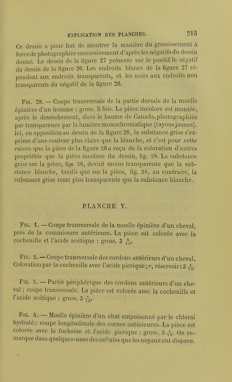 Ce dessin a pour but de montrer la manière du grossissement à force de photographier successivement d'après les négatifs du dessin donné. Le dessin de la figure 27 présente sur le positif le négatif du dessin de la figure 26. Les endroits blancs de la figure 27 ré- pondent aux endroits transparents, et les noirs aux endroits non transparents du négatif de la figure 26. FiG. 28. — Coupe transversale de la partie dorsale de la moelle épinière d'un homme : gross. 5 fois. La pièce incolore est montée, après le dessèchement, dans le baume de Canada,photographiée par transparence par la lumière monochromatique (rayons jaunes). Ici, en opposition au dessin de la figure 26, la substance grise s'ex- prime d'une couleur plus claire que la blanche, et c'est pour cette raison que la pièce de la figure 20 a reçu de la coloration d'autres propriétés que la pièce incolore du dessin, fig. 28. La substance grise sur la pièce, fig*. 26, devint moins transparente que la sub- stance blanche, tandis que sur la pièce, fig. 28, au contraire, la substance grise reste plus transparente que la substance blanche. PLANCHE V. Fig. 1. — Coupe transversale de la moelle épinière d'un cheval, près de la commissure antérieure. La pièce est colorée avec la cochenille et l'acide acétique : gross. 3 ^. Fig. 2. — Coupe transversale des cordons antérieurs d'un cheval. Coloration par la cochenille avec l'acide picrique; réservoir: 3 ^. Fig. 3. — Partie périphérique des cordons antérieurs d'un che- val ; coupe transversale. La pièce est colorée avec la cochenille et l'acide acétique : gross.-3 Fig. U. — Moelle épinière d'un chat empoisonné par le chloral hydraté ; coupe longitudinale des cornes antérieures. La pièce est colorée avec la fuchsine et l'acide picrique : gross. 3 On re- marque dans quelques-unes descel'ules que les noyaux ont disparu.