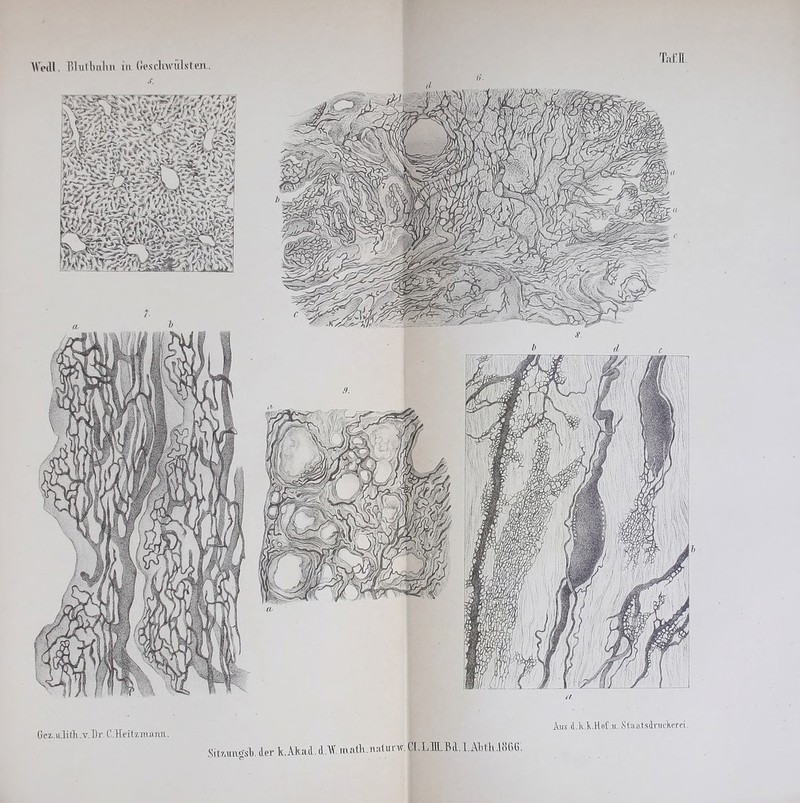 Wedl. Blutbahti ia Geschwülsten-, T«t:n 6. Gez..u.li tli. v. Dr. C. tteitama rm. Aus d.k.X.H»f.u.Staatsat«rk<rei. Sit7Juagsl.derk.Akai.d.W.nxalk.naiurw.|I.L]LBl.I.Al)tkl866.