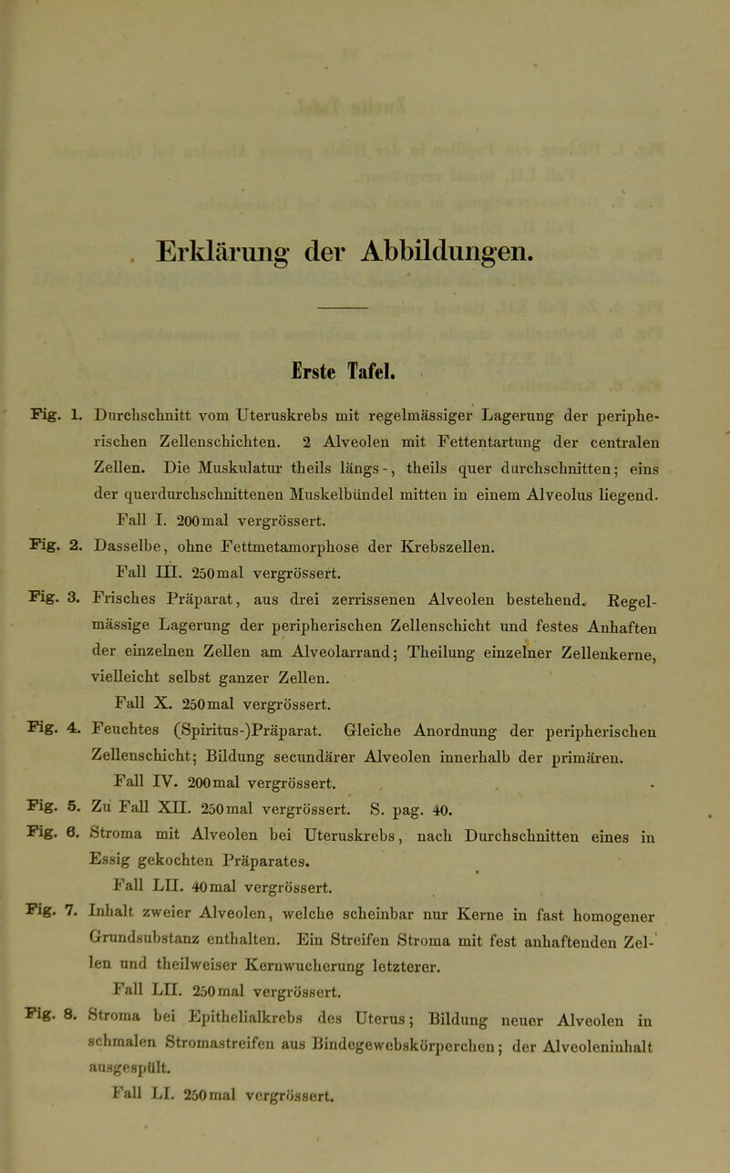 Erklärung der Abbildungen. Erste Tafel. Fig. 1. Durchschnitt vom Uteruskrebs mit regelmässiger Lagerung der periphe- rischen Zellenschichten. 2 Alveolen mit Fettentartung der centralen Zellen. Die Muskulatur theils längs-, theils quer durchschnitten; eins der querdurchschnittenen Muskelbündel mitten in einem Alveolus liegend. Fall I. 200 mal vergrössert. Fig. 2. Dasselbe, ohne Fettmetamorphose der Krebszellen. Fall DL 250mal vergrössert. Fig. 3. Frisches Präparat, aus drei zerrissenen Alveolen bestehend. Eegel- mässige Lagerung der peripherischen Zellenschicht und festes Anhaften der einzelnen Zellen am Alveolarrand; Theilung einzelner Zellenkerne, vielleicht selbst ganzer Zellen. Fall X. 250mal vergrössert. Fig. 4. Feuchtes (Spiritus-)Präparat. Gleiche Anordnung der peripherischen Zellenschicht,- Bildung secundärer Alveolen innerhalb der primären. Fall rV. 200mal vergrössert. Fig. 5. Zu Fall XH. 250 mal vergrössert. S. pag. 40. Fig. 6. Stroma mit Alveolen bei Uteruskrebs, nach Durchschnitten eines in Essig gekochten Präparates. Fall LH. 40 mal vergrössert. Fig. 7. Inhalt zweier Alveolen, welche scheinbar nur Kerne in fast homogener Grundsubstanz enthalten. Ein Streifen Stroma mit fest anhaftenden Zel-' len und theilweiser Kernwucherung letzterer. Fall LH. 250 mal vergrössert. Fig. 8. Stroma bei Epithelialkrebs des Uterus; Bildung neuer Alveolen in schmalen Stromastreifen aus Bindegewebskörperchen; der Alveoleninhalt ausgespült. Fall LI. 250 mal vergrössert.