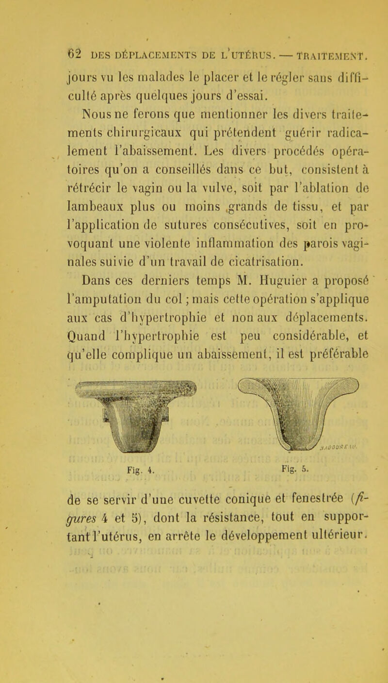 jours vu les malades le placer et le régler sans diffi- culté après quelques jours d'essai. Nous ne ferons que mentionner les divers traite- ments chirurgicaux qui prétendent guérir radica- lement l'abaissement. Les divers procédés opéra- toires qu'on a conseillés dans ce but, consistent à rétrécir le vagin ou la vulve, soit par l'ablation de lambeaux plus ou inoins .grands de tissu, et par l'application de sutures consécutives, soit en pro- voquant une violente inflammation des parois vagi- nales suivie d'un travail de cicatrisation. Dans ces derniers temps M. Huguier a proposé l'amputation du col ; mais cette opération s'applique aux cas d'hypertrophie et non aux déplacements. Quand l'hypertrophie est peu considérable, et qu'elle complique un abaissement, il est préférable Fig. 4. Fig. 5. de se servir d'une cuvette conique et fenestrée {fi- gures 4 et 5), dont la résistance, tout en suppor- tant l'utérus, en arrête le développement ultérieur.