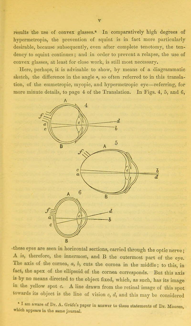 results the use of convex glasses.8 In comparatively high degrees of hypermetropia, the prevention of squint is in fact more particularly desirable, because subsequently, even after complete tenotomy, the ten- dency to squint continues; and in order to prevent a relapse, the use of convex glasses, at least for close work, is still most necessary. Here, perhaps, it is advisable to show, by means of a diagrammatic sketch, the difference in the angle a, so often referred to in this transla- tion, of the emmetropic, myopic, and hypermetropic eye—referring, for more minute details, to page 4 of the Translation. In Figs. 4, 5, and 6, The axis of the cornea, a, b, cuts the cornea in the middle; to this, i fact, the apex of the ellipsoid of the cornea corresponds. But this axi is by no means directed to the object fixed, which, as such, has its image in the yellow spot c. A line drawn from the retinal image of this spot towards its object is the line of vision c, d, and this may be considered • I am aware of Dr. A. Grafe's paper in answer to these statements of Dr. Mooren, which appears in the same journal.