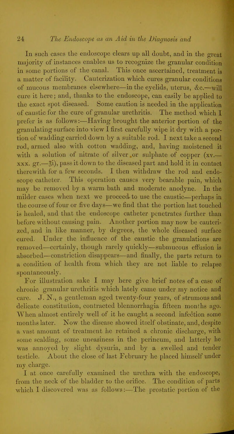 In such cases the endoscope clears up all doubt, and in the great majority of instances enables us to recognize the granular condition in some portions of the canal. This once ascertained, treatment ia a matter of facility. Cauterization which cm-es granular couditiona of mucous membranes elsewhere—in the eyelids, uterus, &c.—will cui'e it here; and, thanks to the endoscope, can easily be applied to the exact spot diseased. Some caution is needed in the application of caustic for the cm-e of granular ui-ethritis. The method which I prefer is as follows:—Having brought the anterior portion of the granulating surface into view 1 first ctu-efully wipe it dry with a por- tion of wadding carried down by a suitable rod, I next take a second rod, armed also with cotton wadding, and, having moistened it with a solution of nitrate of silver .or sulphate of copper (xv.— XXX. gr.—pass it down to the diseased part and hold it in contact therewith lor a few seconds. I then withdraAV the rod and endo- scope catheter. This operation causes veiy bearable pain, which may be remo\ ed by a warm bath and moderate anodyne. In the milder cases when next we proceed to use the caustic—perhaps in the course of four or five days—we find that the portion last touched is healed, and that the endoscope catheter penetrates further than before without causing pain. Another portion may now be cauteri- zed, and in like manner, by degrees, the whole diseased sm-facc cured. Under the influence of the caustic the granulations ai'c removed—certainly, though rarely quickly—submucous effusion is absorbed—constriction disappears—and finally, the parts return to a condition of health from which they are not liable to relapse spontaneously. For illustration sake I may here give brief notes of a case of chronic granular urethritis Avliich lately came under my notice and care. J. N., a gentleman aged twenty-four years, of strumous and delicate constitution, contracted blcnnorrhagla fifteen months ago. AVhen almost entirely well of it he caught a second infection some months later. Now the disease showed itself obstinate, and, despite a vast amount of treatment he retained a chronic discharge, with some scalding, some uneasiness in the perineum, and latterly he was annoyed by slight dysuria, and by a swelled and tender testicle. About the close of last February he placed himself under my charge. I at once carefully examined the urethra with the endoscope, from the neck of the bladder to the orifice. The condition of parts Avhich I discovered was as follows:—The prostatic portion of the