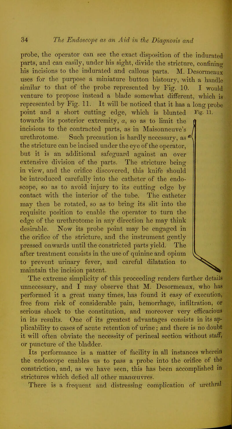 probe, the operator can see the exact disposition of the indurated parts, and can easily, under his sight, divide the stricture, confining his incisions to the indurated and callous parts. M. Desormeaux uses for the pui-pose a miniature button bistoury, with a handle similar to that of the probe represented by Fig. 10. I would venture to propose instead a blade somewhat different, which is represented by Fig. 11. It mil be noticed that it has a long probe point and a short cutting edge, which is blunted Fig. ii. towards its posterior extremity, a, so as to limit the incisions to the contracted parts, as in Maisonneuve's urethrotome. Such precaution is hardly necessary, as the stricture can be incised under the eye of the operator, but it is an additional safeguard against an over extensive division of the parts. The stricture being in view, and the orifice discovered, this knife should be introduced carefully into the catheter of the endo- scope, 80 as to avoid injury to its cutting edge by contact with the interior of the tube. Tlie catheter may then be rotated, so as to bring its slit into the requisite position to enable the operator to turn the edge of the urethrotome in any direction he may think desirable. Now its probe point may be engaged in the orifice of the stricture, and the instrument gently pressed onwards until the constricted parts yield. The after treatment consists in the use of quinine and opium to prevent urinary fever, and careful dilatation to maintain the incision patent. The extreme simplicity of this proceeding renders further details unnecessary, and I may observe that M. Desormeaux, who has performed it a great many times, has found it easy of execution, free from risk of considerable pain, hemorrhage, infiltration, or serious shock to the constitution, and moreover very eflScacious in its results. One of its greatest advantages consists in its ap- plicability to cases of acute retention of urine; and there is no doubt it will often obviate the necessity of perineal section without staff, or puncture of the bladder. Its performance is a matter of facility in aU instances whereiu the endoscope enables us to pass a probe into the orifice of the constriction, and, as we have seen, this has been accomplished in strictures which defied all other manoeuvres. There is a frequent and distressing complication of urethral