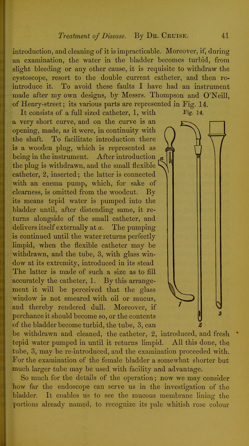 7 introduction, and cleaning of it is impracticable. Moreover, if, during an examination, the water in the bladder becomes turbid, from slight bleeding or any other cause, it is requisite to withdraw the cystoscope, resort to the double current catheter, and then re- introduce it. To avoid these faults I have had an instrument made after my own designs, by Messrs. Thompson and O'Neill, of Henry-street; its various parts are represented in Fig. 14. It consists of a full sized catheter, 1, with Fig. 14. a very short curve, and on the curve is an opening, made, as it were, in continuity with the shaft. To facilitate introduction there is a wooden plug, which is represented as being in the instrument. After introduction the plug is withdi'awn, and the small flexible catheter, 2, inserted; the latter is connected \ Avith an enema pump, which, for sake of clearness, is omitted from the woodcut. By its means tepid water is pumped into the bladder until, after distending same, it re- turns alongside of the small catheter, and delivers itself externally at a. The pumping is continued until the water returns perfectly limpid, when the flexible catheter may be withdrawn, and the tube, 3, with glass win- dow at its extremity, introduced in its stead The latter is made of such a size as to fill accurately the catheter, 1. By this arrange- ment it will be perceived that the glass AvindoAT is not smeared with oil or mucus, and thereby rendered dull. Moreover, if perchance it should become so, or the contents of the bladder become turbid, the tube, 3, can be withdrawn and cleaned, the catheter, 2, introduced, and fresh tepid water pumped in until it returns limpid. All this done, the tube, 3, may be re-introduced, and the examination proceeded with. For the examination of the female bladder a somewhat shorter but much larger tube may be used with facility and advantage. So much for the details of the operation; now we may consider how far the endoscope can serve us in the investigation of the bladder. It enables us to see the mucous membrane lining the portions ah'eady named, to recognize its pale whitish rose coloiu' Z