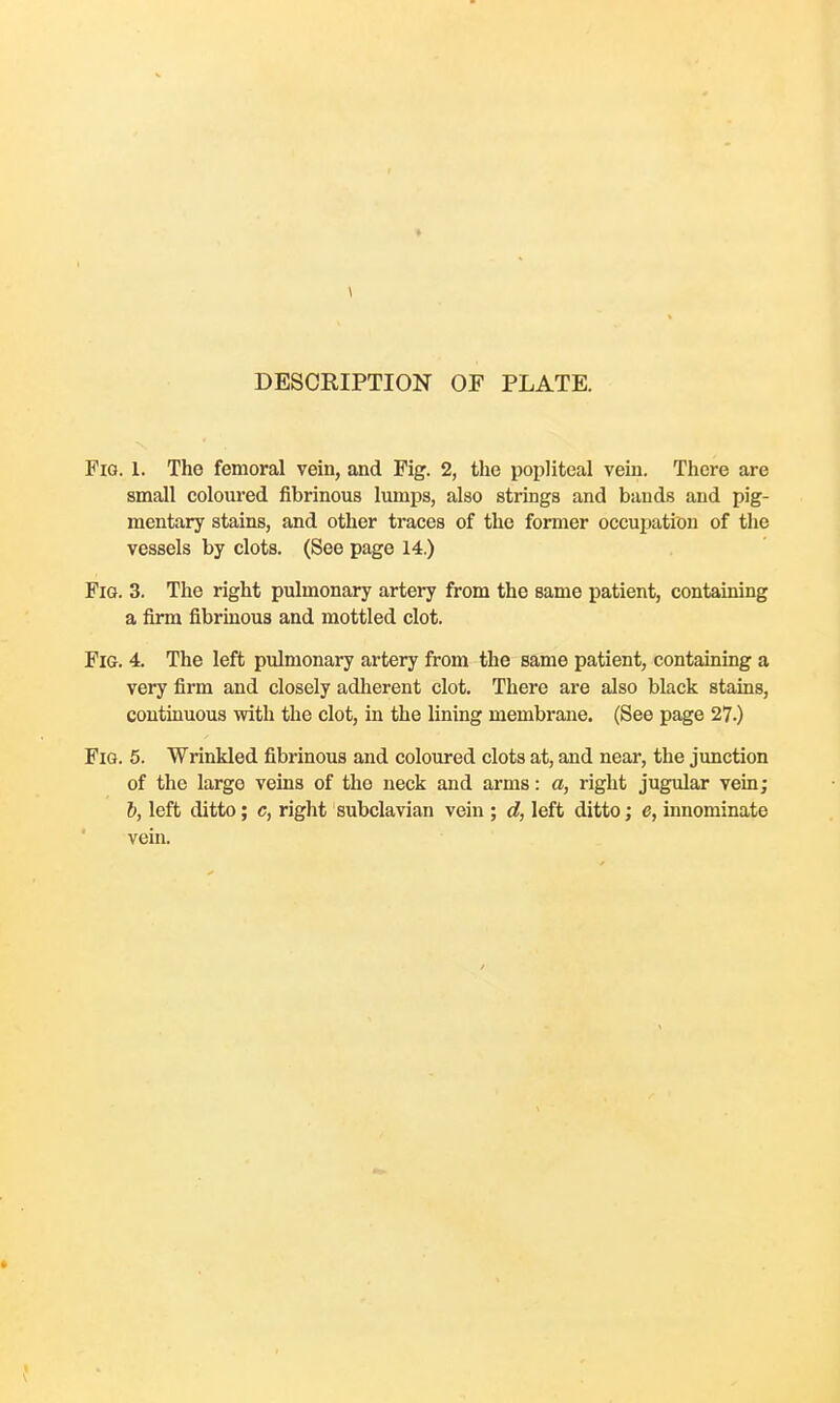 DESCRIPTION OF PLATE. Fig. 1. The femoral vein, and Fig. 2, the popliteal vein. There are small coloured fibrinous lumps, also strings and bauds and pig- mentary stains, and other traces of the former occupation of the vessels by clots. (See page 14.) Fig. 3. The right pulmonary artery from the same patient, containing a firm fibrinous and mottled clot. Fig. 4. The left pulmonary artery from the same patient, containing a very firm and closely adherent clot. There are also black stains, continuous with the clot, in the lining membrane. (See page 27.) Fig. 5. Wrinkled fibrinous and coloured clots at, and near, the junction of the large veins of the neck and arms: a, right jugular vein; 6, left ditto; c, right subclavian vein ; d, left ditto; e, innominate vein.