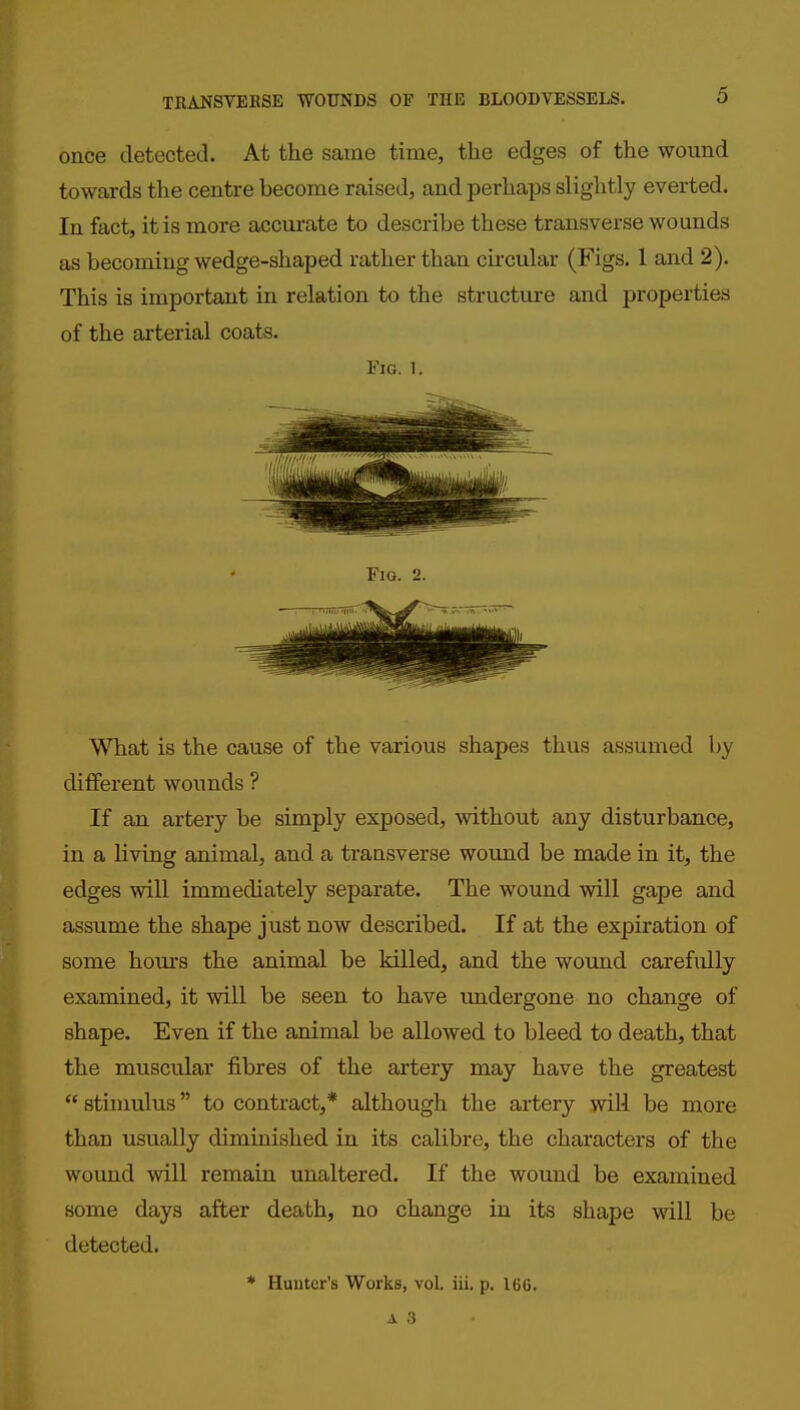 once detected. At the satne time, the edges of the wound towards the centre become raised, and perhaps slightly everted. In fact, it is more accui-ate to describe these transverse wounds as becoming wedge-shaped rather than ch'cular (Figs. 1 and 2). This is important in relation to the structure and properties of the arterial coats. Fig. 1. Fig. 2. What is the cause of the various shapes thus assumed by different wounds ? If an artery be simply exposed, without any disturbance, in a living animal, and a transverse wound be made in it, the edges will immediately separate. The wound will gape and assume the shape just now described. If at the expiration of some hours the animal be killed, and the wound carefully examined, it will be seen to have undergone no change of shape. Even if the animal be allowed to bleed to death, that the muscular fibres of the artery may have the greatest  stimulus to contract,* although the artery will be more than usually diminished in its calibre, the characters of the wound will remain unaltered. If the wound be examined some days after death, no change in its shape will be detected. * Hunter's Works, vol. iii. p. 166.