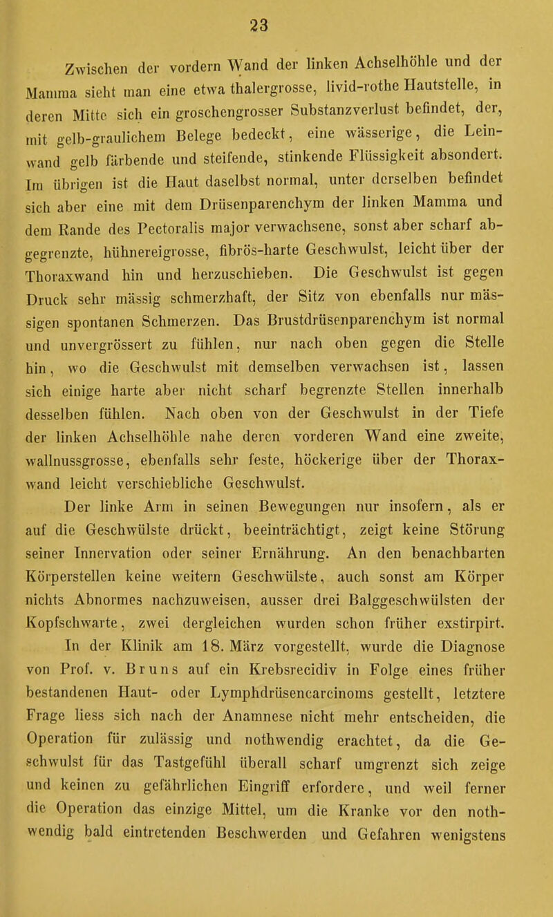 Zwischen der vordem Wand der linken Achseliiöhle und der Mamma sieht man eine etwa thalergrosse, livid-rothe Hautstelle, in deren Mitte sich ein groschengrosser Substanzverlust befindet, der, mit gelb-graulichem Belege bedeckt, eine wässerige, die Lein- wand gelb färbende und steifende, stinkende Flüssigkeit absondert. Im übrigen ist die Haut daselbst normal, unter derselben befindet sich aber eine mit dem Drüsenparenchym der linken Mamma und dem Rande des Pectoralis major verwachsene, sonst aber scharf ab- gegrenzte, hühnereigrosse, fibrös-harte Geschwulst, leicht über der Thoraxwand hin und herzuschieben. Die Geschwulst ist gegen Druck sehr mässig schmerzhaft, der Sitz von ebenfalls nur mas- sigen spontanen Schmerzen. Das Brustdrüsenparenchym ist normal und unvergrössert zu fühlen, nur nach oben gegen die Stelle hin, wo die Geschwulst mit demselben verwachsen ist, lassen sich einige harte aber nicht scharf begrenzte Stellen innerhalb desselben fühlen. Nach oben von der Geschwulst in der Tiefe der linken Achselhöhle nahe deren vorderen Wand eine zweite, wallnussgrosse, ebenfalls sehr feste, höckerige über der Thorax- wand leicht verschiebliche Geschwulst, Der linke Arm in seinen Bewegungen nur insofern, als er auf die Geschwülste drückt, beeinträchtigt, zeigt keine Störung seiner Innervation oder seiner Ernährung. An den benachbarten Körperstellen keine weitern Geschwülste, auch sonst am Körper nichts Abnormes nachzuweisen, ausser drei Balggeschwülsten der Kopfschwarte, zwei dergleichen wurden schon früher exstirpirt. In der Klinik am 18. März vorgestellt, wurde die Diagnose von Prof. V. Bruns auf ein Krebsrecidiv in Folge eines früher bestandenen Haut- oder Lymphdrüsencarcinoms gestellt, letztere Frage Hess sich nach der Anamnese nicht mehr entscheiden, die Operation für zulässig und nothwendig erachtet, da die Ge- schwulst für das Tastgefühl überall scharf umgrenzt sich zeige und keinen zu gefährlichen Eingriff erfordere, und weil ferner die Operation das einzige Mittel, um die Kranke vor den noth- wendig bald eintretenden Beschwerden und Gefahren wenigstens