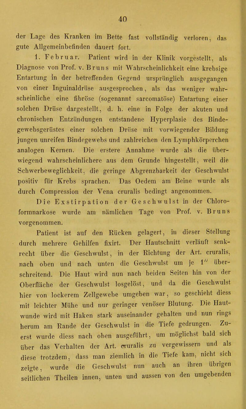 der Lage des Kranken im Bette fast vollständig verloren, das gute Allgemeinbefinden dauert fort. 1. Februar. Patient wird in der Klinik vorgestellt, als Diagnose von Prof. v. Bruns mit Wahrscheinlichkeit eine krebsige Entartung in der betreffenden Gegend ursprünglich ausgegangen von einer Inguinaldrüse ausgesprochen, als das weniger wahr- scheinliche eine fibröse (sogenannt sarcomatöse) Entartung einer solchen Drüse dargestellt, d. h. eine in Folge der akuten und chronischen Entzündungen entstandene Hyperplasie des Binde- gewebsgerüstes einer solchen Drüse mit vorwiegender Bildung jungen unreifen Bindegewebs und zahlreichen den Lymphkörperchen analogen Kernen. Die erstere Annahme wurde als die über- wiegend wahrscheinlichere aus dem Grunde hingestellt, weil die Schwerbeweglichkeit, die geringe Abgrenzbarkeit der Geschwulst positiv für Krebs sprachen. Das Oedem am Beine wurde als durch Compression der Vena cruralis bedingt angenommen. Die Exstirpation der Geschwulst in der Chloro- formnarkose wurde am nämlichen Tage von Prof. v. Bruns vorgenommen. Patient ist auf den Rücken gelagert, in dieser Stellung durch mehrere Gehilfen fixirt. Der Hautschnitt verläuft senk- recht über die Geschwulst, in der Richtung der Art. cruralis, nach oben und nach unten die Geschwulst um je 1 über- schreitend. Die Haut wird nun nach beiden Seiten hin von der Oberfläche der Geschwulst losgelöst, und da die Geschwulst hier von lockerem Zellgewebe umgeben war, so geschieht diess mit leichter Mühe und nur geringer venöser Blutung. Die Haut- wunde wird mit Haken stark auseinander gehalten und nun rings herum am Rande der Geschwulst in die Tiefe gedrungen. Zu- erst wurde diess nach oben ausgeführt, um möglichst bald sich über das Verhalten der Art. cruralis zu vergewissern und als diese trotzdem, dass man ziemlich in die Tiefe kam, nicht sich zeigte, wurde die Geschwulst nun auch an ihren übrigen seitlichen Theilen innen, unten und aussen von den umgebenden i