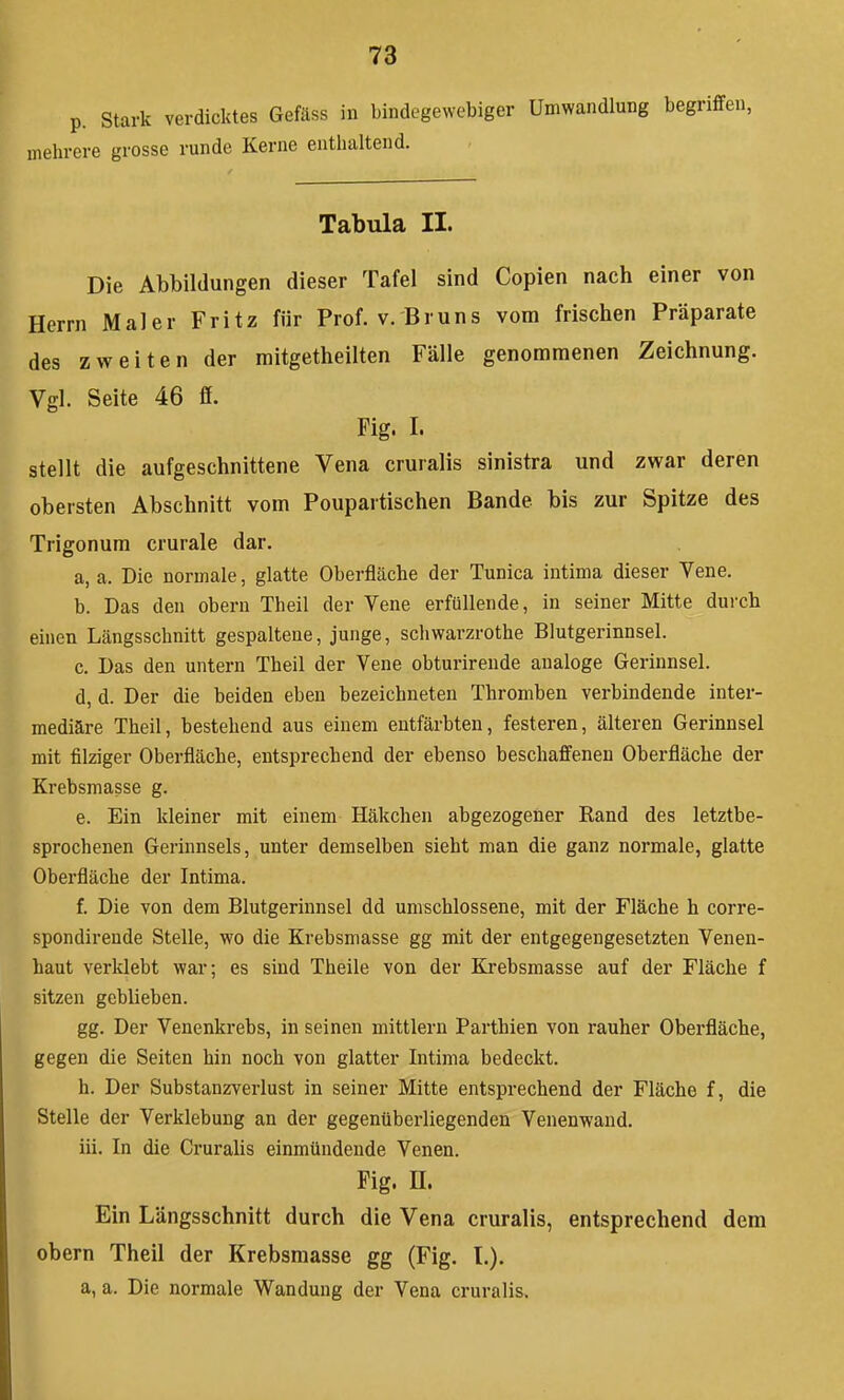 p. stark verdicktes Gefäss in bindegewebiger Umwandlung begriffen, mehrere grosse runde Kerne enthaltend. Tabula II. Die Abbildungen dieser Tafel sind Copien nach einer von Herrn Maler Fritz für Prof. v. Bruns vom frischen Präparate des zweiten der mitgetheilten Fälle genommenen Zeichnung. Vgl. Seite 46 ff. Fig. I. stellt die aufgeschnittene Vena cruralis sinistra und zwar deren obersten Abschnitt vom Poupartischen Bande bis zur Spitze des Trigonum crurale dar. a. a. Die normale, glatte Oberfläche der Tunica intima dieser Yene. b. Das den obern Theil der Vene erfüllende, in seiner Mitte durch einen Längsschnitt gespaltene, junge, schwarzrothe Blutgerinnsel. c. Das den untern Theil der Vene obturireude analoge Gerinnsel. d. d. Der die beiden eben bezeichneten Thromben verbindende inter- mediäre Theil, bestehend aus einem entfärbten, festeren, älteren Gerinnsel mit filziger Oberfläche, entsprechend der ebenso beschaffenen Oberfläche der Krebsmasse g. e. Ein kleiner mit einem Häkchen abgezogener Rand des letztbe- sprochenen Gerinnsels, unter demselben sieht man die ganz normale, glatte Oberfläche der Intima. f. Die von dem Blutgerinnsel dd umschlossene, mit der Fläche h corre- spondirende Stelle, wo die Krebsmasse gg mit der entgegengesetzten Venen- haut verldebt war; es sind Theile von der Krebsmasse auf der Fläche f sitzen geblieben. gg. Der Venenkrebs, in seinen mittlem Parthien von rauher Oberfläche, gegen die Seiten hin noch von glatter Intima bedeckt. h. Der Substanzverlust in seiner Mitte entsprechend der Fläche f, die Stelle der Verklebung an der gegenüberliegenden Venenwand. iii. In die Cruralis einmündende Venen. Fig. n. Ein Längsschnitt durch die Vena cruralis, entsprechend dem obern Theil der Krebsmasse gg (Fig. T.). a, a. Die normale Wandung der Vena cruralis.