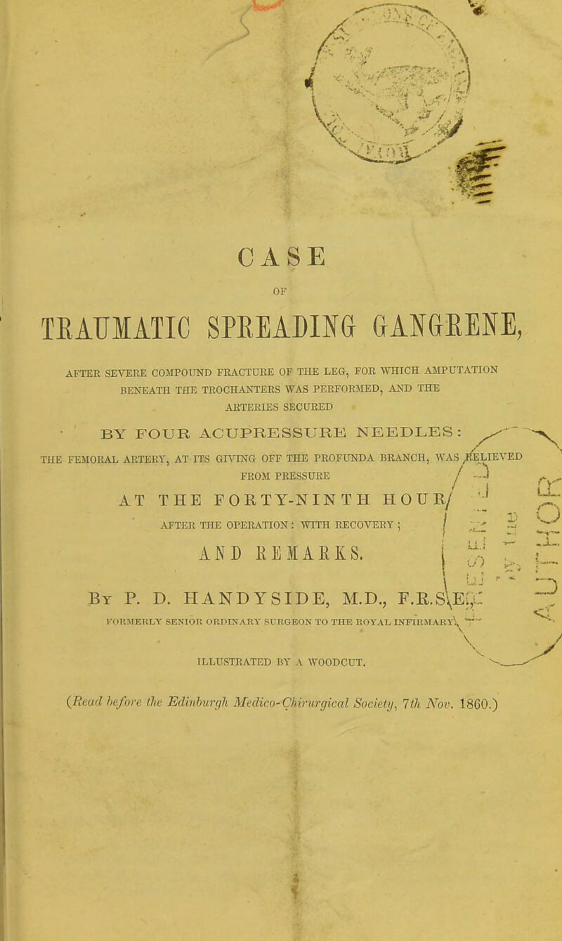 CASE OF TRAUMATIC SPREADING GANGRENE, AFTER SEVERE COMPOUND FRACTURE OF THE LEG, FOR WHICH AMPUTATION BENEATH THE TROCHANTERS WAS PERFORMED, AND THE ARTERIES SECURED BY FOUR ACUPRESSURE NEEDLES: THE FEMORAL ARTERY, AT ITS GIVING OFF THE PROFUNDA BRANCH, WAS /l!ELIEVED FROM PRESSURE j ~J AT THE FORT Y-N I N T II H 0 U R/' 1 AFTER THE OPERATION! WITH RECOVERY; j * ^ AND REMARKS. Br P. D. HANDY SIDE, M.D., F.R.SlE., FORMERLY SENIOR ORDINARY SURGEON TO THE ROYAL INFIRMARYi, ILLUSTRATED BY A WOODCUT. \ (Read before the Edinburgh Medico-Chiritrgical Society, 7th Nor. 1860.)