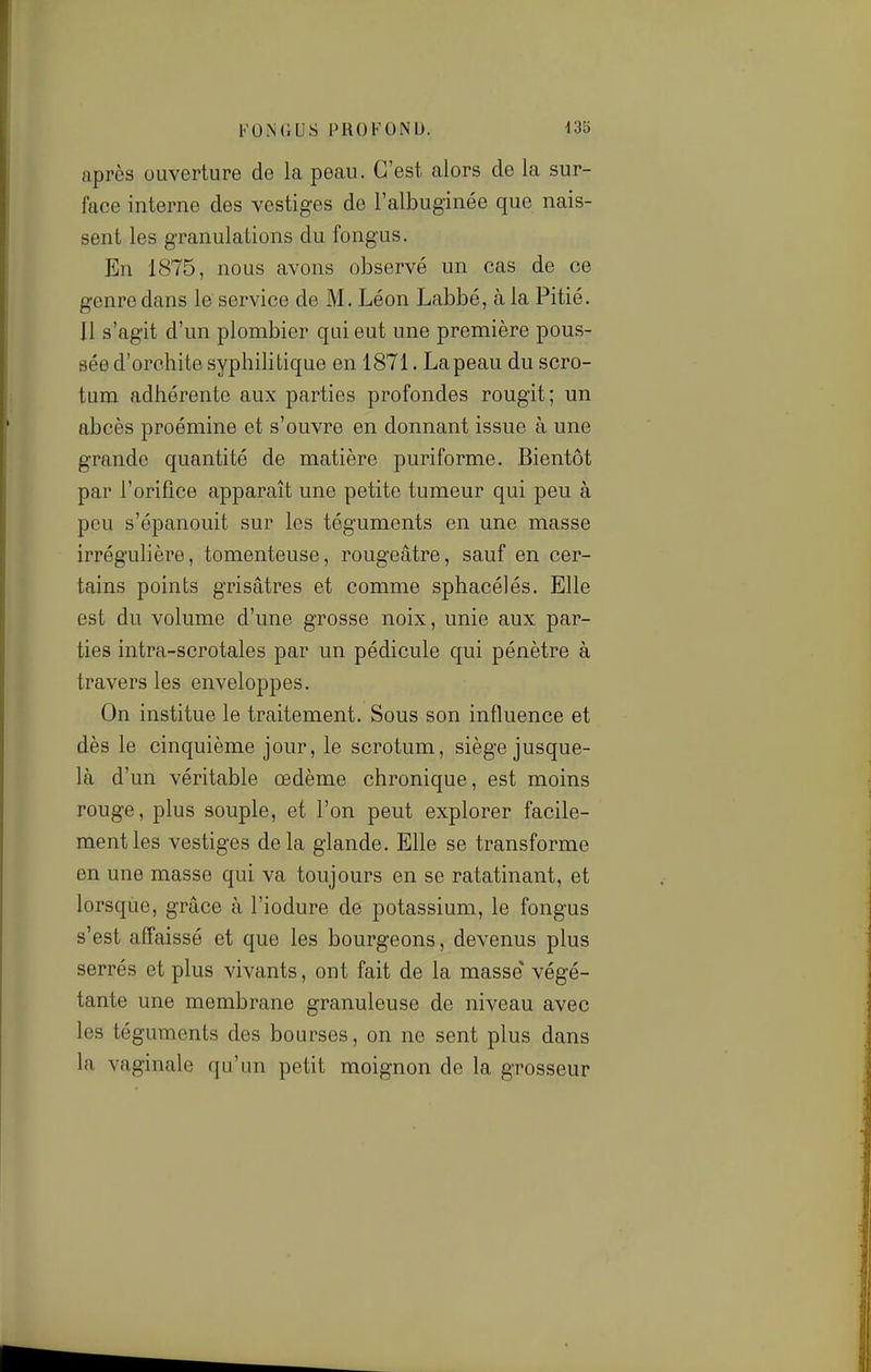 FO.NGUS PROFONU. i3b après ouverture de la peau. C'est alors de la sur- face interne des vestiges de l'albuginée que nais- sent les granulations du fongus. En 1875, nous avons observé un cas de ce genre dans le service de M. Léon Labbé, à la Pitié. Il s'agit d'un plombier qui eut une première pous- sée d'orchite syphilitique en 1871. La peau du scro- tum adhérente aux parties profondes rougit; un abcès proémine et s'ouvre en donnant issue à une grande quantité de matière puriforme. Bientôt par l'orifice apparaît une petite tumeur qui peu à peu s'épanouit sur les téguments en une masse irréguhère, tomenteuse, rougeâtre, sauf en cer- tains points grisâtres et comme sphacélés. Elle est du volume d'une grosse noix, unie aux par- ties intra-scrotales par un pédicule qui pénètre à travers les enveloppes. On institue le traitement. Sous son influence et dès le cinquième jour, le scrotum, siège jusque- là d'un véritable œdème chronique, est moins rouge, plus souple, et l'on peut explorer facile- ment les vestiges delà glande. Elle se transforme en une masse qui va toujours en se ratatinant, et lorsqùe, grâce à l'iodure de potassium, le fongus s'est affaissé et que les bourgeons, devenus plus serrés et plus vivants, ont fait de la masse végé- tante une membrane granuleuse de niveau avec les téguments des bourses, on ne sent plus dans la vaginale qu'un petit moignon de la grosseur