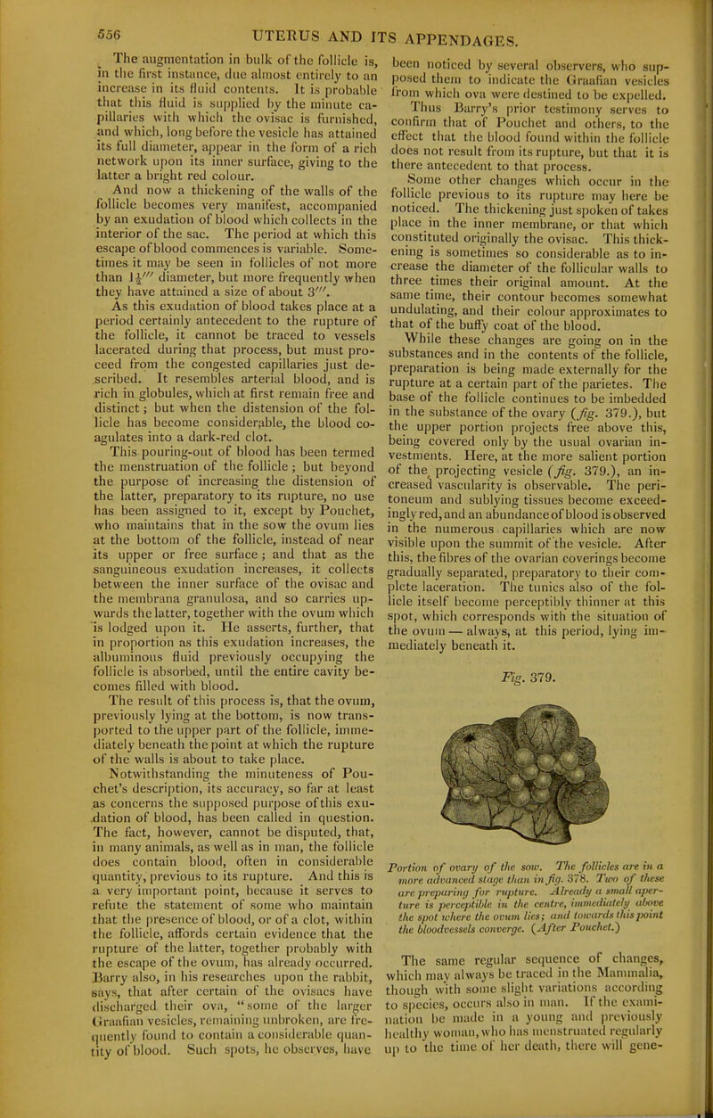 The augmentation in bulk of the follicle is, jn the first instance, due almost entirely to an increase in its fluid contents. It is probable that this fluid is supplied by the minute ca- pillaries with which the ovisac is furnished, and which, long before the vesicle has attained its full diameter, appear in the form of a rich network upon its inner surface, giving to the latter a bright red colour. And now a thickening of the walls of the follicle becomes very manifest, accompanied by an exudation of blood which collects in the interior of the sac. The period at which this escape of blood commences is variable. Some- times it may be seen in follicles of not more than H' diameter, but more frequently when they have attained a size of about 3'. As this exudation of blood takes place at a period certainly antecedent to the rupture of the follicle, it cannot be traced to vessels lacerated during that process, but must pro- ceed from the congested capillaries just de- scribed. It resembles arterial blood, and is rich in globules, which at first remain free and distinct; but when the distension of the fol- licle has become considerable, the blood co- agulates into a dark-red clot. This pouring-out of blood has been termed the menstruation of the follicle ; but beyond the purpose of increasing the distension of the latter, preparatory to its rupture, no use has been assigned to it, except by Pouchet, who maintains that in the sow the ovum lies at the bottom of the follicle, instead of near its upper or free surface ; and that as the sanguineous exudation increases, it collects between the inner surface of the ovisac and the membrana granulosa, and so carries up- wards the latter, together with the ovum which is lodged upon it. He asserts, further, that in proportion as this exudation increases, the albuminous fluid previously occupying the follicle is absorbed, until the entire cavity be- comes filled with blood. The result of this process is, that the ovum, previously lying at the bottom, is now trans- ported to the upper part of the follicle, imme- diately beneath the point at which the rupture of the walls is about to take place. Notwithstanding the minuteness of Pou- chet's description, its accuracy, so far at least as concerns the SLipposed purpose of this exu- •dation of blood, has been called in question. The fact, however, cannot be disputed, that, in many animals, as well as in man, the follicle does contain blood, often in considerable quantity, previous to its rupture. And this is a very important point, because it serves to refute the statement of some who maintain that the presence of blood, or of a clot, within the follicle, affords certain evidence that the rupture of the latter, together probably with the escape of the ovum, has already occurred. Uarry also, in his researches upon the rabbit, says, that after certain of the ovisacs have discharged their ova,  some of the larger Graafian vesicles, remaining unbroken, are fre- quently found to contain a considerable quan- tity ol blood. Such spots, he observes, have been noticed by several observers, wlio sup- posed them to indicate the Graafian vesicles from which ova were destined to be expelled. Thus Barry's prior testimony serves to confirm that of Pouchet and others, to the efl^ect that the blood found within the follicle does not result from its rupture, but that it is there antecedent to that process. Some other changes which occur in the follicle previous to its rupture may here be noticed. The thickening just spoken of takes place in the inner membrane, or that which constituted originally the ovisac. This thick- ening is sometimes so considerable as to in- crease the diameter of the follicular walls to three times their original amount. At the same time, their contour becomes somewhat undulating, and their colour approximates to that of the buffy- coat of the blood. While these changes are going on in the substances and in the contents of the follicle, preparation is being made externally for the rupture at a certain part of the parietes. The base of the follicle continues to be imbedded in the substance of the ovary (Jtg. 379.), but the upper portion projects free above this, being covered only by the usual ovarian in- vestments. Here, at the more salient portion of the projecting vesicle (Jig. 379.), an in- creased vascularity is observable. The peri- toneum and sublying tissues become exceed- ingly red,and an abundanceof blood is observed in the numerous capillaries which are now visible upon the summit of the vesicle. After this, the fibres of the ovarian coverings become gradually separated, preparatory to their com- plete laceration. The tunics also of the fol- licle itself become perceptibly thinner at this spot, which corresponds with the situation of the ovum — always, at this period, lying im- mediately beneath it. Fig. 379. Portion of ovary of the smo. The follicles are in a more advanced stage than in fig- 378. Two of these are preparing for rupture. Already a small aper- ture is jmcepiible in the centre, immcdititeli/ altove ike spot wliere the ovum lies; and towards this imint t/te bloodvessels converge. {After Pouchet.) The same regular sequence of changes, which may always be traced in the Mammalia, though with some slight variations according to species, occurs also in man. If the exami- nation be made in a young and previously healthy woman, who has menstruated regularly u[) to the time of her deiith, there will gene-