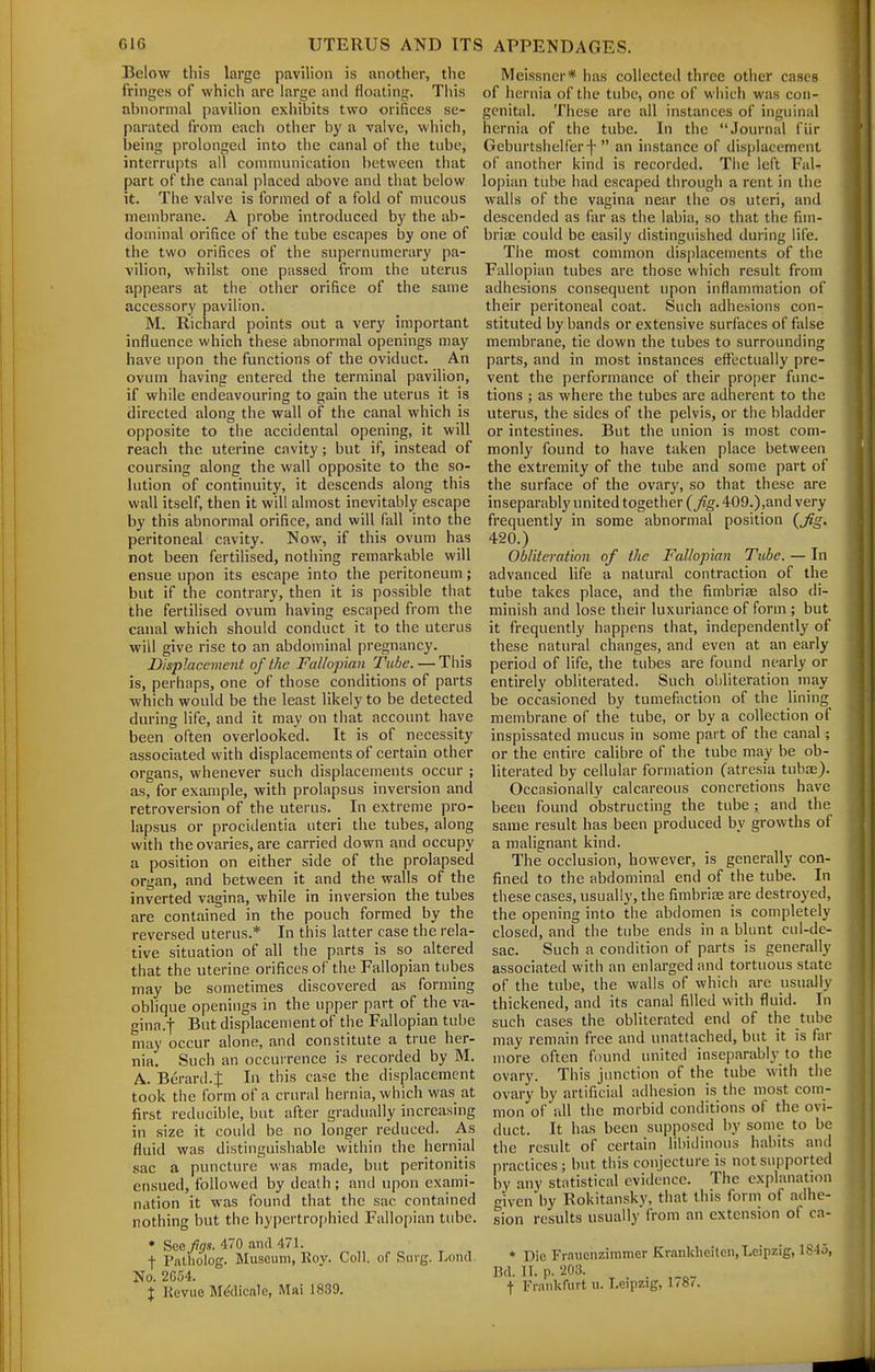 Below this large pavilion is another, the fringes of which are large and floating. Tiiis abnormal pavilion exhibits two orifices se- parated from each other by a valve, which, being prolonged into the canal of the tube, interrupts all communication between that part of the canal placed above and that below it. The valve is formed of a fold of mucous membrane. A probe introduced by the ab- dominal orifice of the tube escapes by one of the two orifices of the supernumerary pa- vilion, whilst one passed from the uterus appears at the other orifice of the same accessory pavilion. M. Richard points out a very important influence which these abnormal openings may have upon the functions of the oviduct. An ovum having entered the terminal pavilion, if while endeavouring to gain the uterus it is directed along the wall of the canal which is opposite to the accidental opening, it will reach the uterine cavity; but if, instead of coursing along the wall opposite to the so- lution of continuity, it descends along this wall itself, then it will almost inevitably escape by this abnormal orifice, and will fall into the peritoneal cavity. Now, if this ovum has not been fertilised, nothing remarkable will ensue upon its escape into the peritoneum; but if the contrary, then it is possible that the fertilised ovum having escaped from the canal which should conduct it to the uterus will give rise to an abdominal pregnancy. Displacement of the Fallopian Tube. — This is, perhaps, one of those conditions of parts which would be the least likely to be detected during life, and it may on that account have been often overlooked. It is of necessity associated with displacements of certain other organs, whenever such displacements occur ; as, for example, with prolapsus inversion and retroversion of the uterus. In extreme pro- lapsus or procidentia uteri the tubes, along with the ovaries, are carried down and occupy a position on either side of the prolapsed organ, and between it and the walls of the inverted vagina, while in inversion the tubes are contained in the pouch formed by the reversed uterus.* In this latter case the rela- tive situation of all the parts is so altered that the uterine orifices of the Fallopian tubes may be sometimes discovered as forming oblique openings in the upper part of the va- gina.f But displacement of the Fallopian tube may occur alone, and constitute a true her- nia. Such an occurrence is recorded by M. A. Berard.J In this case the displacement took the form of a crural hernia, which was at first reducible, but after gradually increasing in size it could be no longer reduced. As fluid was distinguishable within the hernial sac a puncture was made, but peritonitis ensued, followed by death; and upon exami- nation it was found that the sac contained nothing but the hypertro[)hied Fallopian tube. • See figs. 470 and 471. f Pnlholog. Museum, Roy. Coll. of Surg. Loud No. 2654. X Revue MAlicnlc, Mai 1839. Meissner* has collected three other cases of hernia of the tube, one of which was con- genital. These arc all instances of inguinal hernia of the tube. In the Journal fiir Geburtshelferf  an instance of displacement of another kind is recorded. The left Fal- lopian tube had escaped through a rent in the walls of the vagina near the os uteri, and descended as far as the labia, so that the fim- briae could be easily distinguished during life. The most common tlisplacements of the Fallopian tubes are those which result from adhesions consequent upon inflammation of their peritoneal coat. Such adhesions con- stituted by bands or extensive surfaces of false membrane, tie down the tubes to surrounding parts, and in most instances effectually pre- vent the performance of their proper func- tions ; as where the tubes are adherent to the uterus, the sides of the pelvis, or the bladder or intestines. But the union is most com- monly found to have taken place between the extremity of the tube and some part of the surface of the ovary, so that these are inseparably united together (fig. 409.),and very frequently in some abnormal position {Jig. 420.) Obliteration of the Fallopian Tube. — In advanced life a natural contraction of the tube takes place, and the fimbriae also di- minish and lose their luxuriance of form ; but it frequently happens that, independently of these natural changes, and even at an early period of life, the tubes are found nearly or entirely obliterated. Such obliteration may be occasioned by tumefaction of the lining membrane of the tube, or by a collection of inspissated mucus in some part of the canal; or the entire calibre of the tube may be ob- literated by cellular formation (atresia tubae). Occasionally calcareous concretions have been found obstructing the tube; and the same result has been produced by growths of a malignant kind. The occlusion, however, is generally con- fined to the abdominal end of the tube. In these cases, usually, the fimbriae are destroyed, the opening into the abdomen is completely closed, and the tube ends in a blunt cul-de- sac. Such a condition of parts is generally associated with an enlarged and tortuous state of the tube, the walls of which are usually thickened, and its canal filled with fluid. In such cases the obliterated end of the tube may remain free and unattached, but it is far more often found united inseparably to the ovary. This junction of the tube with the ovary by artificial adhesion is the most com- mon ol' all the morbid conditions of the ovi- duct. It has been supposed by some to be the result of certain libidinous habits and practices ; but this conjecture is not supported by any statistical evidence. The explanation given by Rokitansky, that this form of adhe- sion results usually from an extension of ca- * Die Fraucnzinimer Krankheiten, Leipzig, 1845, Bd. H. p. 203. t Fnnikfurt u. Leipzig, 1/8/.