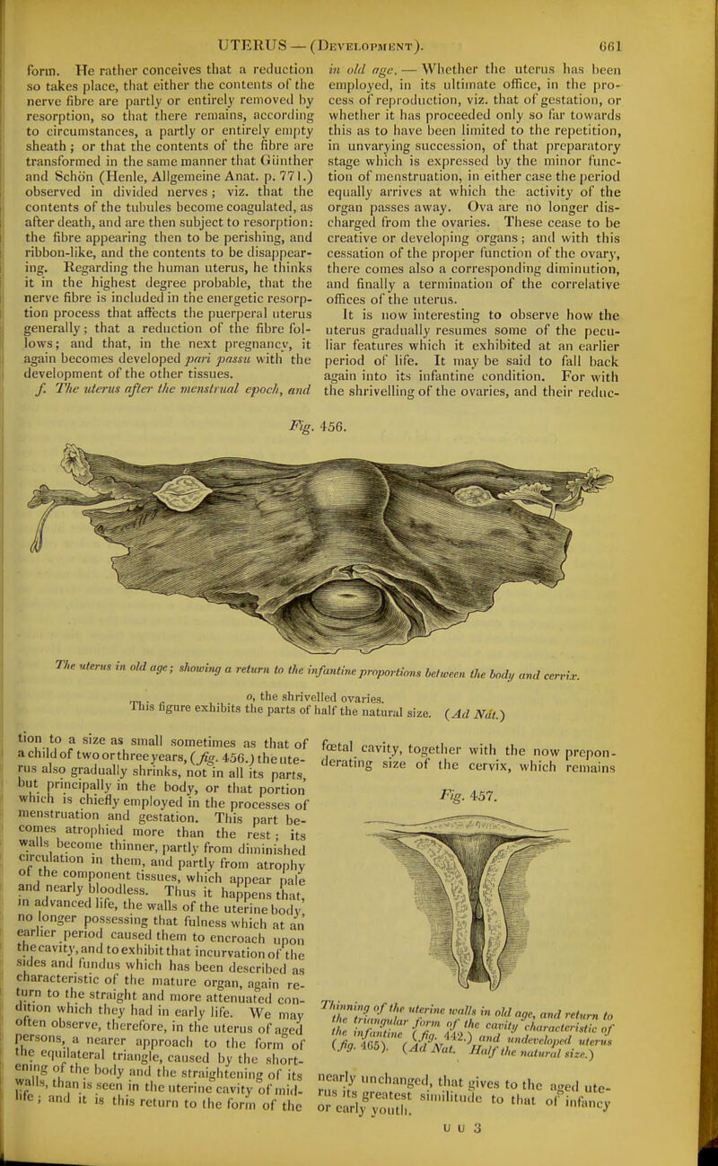 form. He rather conceives that a reduction so takes place, that either the contents of the nerve fibre are partly or entirely removed by resorption, so that there remains, according to circumstances, a partly or entirely empty sheath ; or that the contents of the fibre are transformed in the same manner that Giinther and Schdn (Henle, Allgemeine Anat. p. 771.) observed in divided nerves; viz. that the contents of the tubules become coagulated, as after death, and are then subject to resorption: the fibre appearing then to be perishing, and ribbon-like, and the contents to be disappear- ing. Regarding the human uterus, he thinks it in the highest degree probable, that the nerve fibre is included in the energetic resorp- tion process that affects the puerperal uterus generally; that a reduction of the fibre fol- lows; and that, in the next pregnancy, it again becomes developed pari passu with the development of the other tissues. f. The uiei-us after the viemtrual epoch, and in old age. — Whether the uterus has been employed, in its ultimate office, in the pro- cess of reproduction, viz. that of gestation, or whether it has proceeded only so far towards this as to have been limited to the repetition, in unvarying succession, of that preparatory stage which is expressed by the minor func- tion of menstruation, in either case the |)eriod equally arrives at which the activity of the organ passes away. Ova are no longer dis- charged from the ovaries. These cease to be creative or developing organs; and with this cessation of the proper function of the ovary, there comes also a corresponding diminution, and finally a termination of the correlative offices of the uterus. It is now interesting to observe how the uterus gradually resumes some of the pecu- liar features which it exhibited at an earlier period of life. It may be said to fall back again into its infantine condition. For with the shrivelling of the ovaries, and their reduc- Fig. 456. The uterus in old age; showing a return to the infantine proportions between the body and cervix. . - the shrivelled ovaries. This figure exhibits the parts of half the natural size. {Ad Ndt.) tion to a size as small sometimes as that of a child of two or three years, {fig. 456.) the ute- rus also gradually shrinks, not in all its parts but principally in the body, or that portion which is chiefly employed in the processes of menstruation and gestation. Tliis part be- comes atrophied more than the rest ; its walls become thinner, partly from diminished circulation in them, and partly from atrophy of the component tissues, which appear pale and nearly bloodless. Thus it happens that, m advanced life, the walls of the uterine bodv no longer possessing that fulness which at an earlier period caused them to encroach upon thecavity,and toexhibitthat incurvation of the sides and fundus which has been described as cfiaracteristic of the mature organ, again re- turn to the straight and more attenuated con- tlition which they had in early life. We may often observe, therefore, in the uterus of aged persons, a nearer approach to the form of the equilateral triangle, caused by the short- ening of the body and the straightening of its wans, than IS seen in the uterine cavity of mid- te; and it is this return to the form of the foetal cavity, together with the now prepon- derating size of the cervix, which remains Fig. 457. Thinning of the uterine walls in old age, and retvrn to the tnangular form of the cavity d,Zctcr Z of 405). (Ad Nat. Half the natural size.) nearly unchanged, that gives to the aged ute-