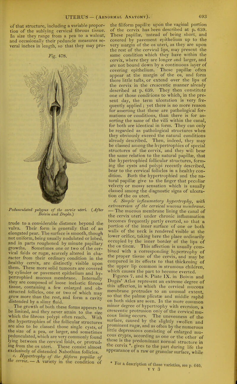 UTERUS - (Abi of that structure, including a variable propor- tion of the subl^ving cervical fibrous tissue. In size they range from a pea to a walnut, and occasionally their peduncle measures se- veral inches in length, so that they may pro- Fig. 478. Pedunculated polypus of the cervix uteri. {After Boivin and JDuges.) trude to a considerable distance beyond the vulva. Their form is generally that of an elongated pear. The surface is smooth, though not uniform, being usually nodulated orlobed, and in parts roughened by minute papillary growths. Sometimes one or two of the cer- vical folds or rugas, scarcely altered in cha- racter from their ordinary condition in the healthy cervix, are distinctly visible upon them. These more solid tumours are covered by cylinder or pavement epithelium and hy- penrophied mucous membrane. Internally they are composed of loose ineUiStic fibrous tissue, containing a few enlarged and ob- structed follicles, one or two of which may grow more than the rest, and form a cavity distended by a slimy fluid. The growth of both these forms appears to be limited, and they never attain to the size ■which the fibrous polypi often reach. With the hypertrophies of the follicular structures are also to be classed those single cysts, of the size of a pea, or larger, and sometimes f)edunculated, which are very commonly found ying between the cervical folds, or protrud- ing from the os uteri. These consist almost exclusively of distended Nabothian follicles. c. Hypertrophy of the Jiliform papilla: of the cervix. — A variety in the condition of FORMAL Anatomy). C93 the filiform papillne upon the vaginal portion of the cervix has been described at p. 639. These papillae, nstead of being short, and covered by pavement epithelium up to the very margin of the os uteri, as they are upon the rest of the cervical lips, may present the same condition which they have within the cervix, where they are longer and larger, and are not bound down by a continuous la} er of covering epithelium. These papillae often appear at the margin of the os, and form there little tufts, or extend over the lips of the cervix in the crescentic manner already described at p. 639. They then constitute one of those conditions to which, in the pre- sent day, the term ulceration is very fre- quently applied ; yet there is no more reason for asserting that these are pathological for- mations or conditions, than there is for as- serting the same of the villi within the canal, for both are identical in form. They can only be regarded as pathological structures when they obviously exceed the natural conditions already described. Then, indeed, they may be classed among the hvpertrophies of special structures of the cervix, and they will bear the same relation to the natural papillae, that the hypertrophied follicular structures, form- ing the cysts and polypi recently described, bear to the cervical follicles in a healthy con- dition. Both the hypertrophied and the na- tural papillae give to the finger that peculiar velvety or mossy sensation which is usually classed among the diagnostic signs of ulcera- tion of the OS uteri. d. Simple inflammatory hypertrophy, with extrovemion of the cervical mucous membraiie. — The mucous membrane lining the canal of the cervix uteri under chronic inflammation becomes frequently partly everted, so that a portion of the inner surface of one or both walls of the neck is rendered visible at the lower orifice, taking here the place ordinarily occupied by the inner border of the lips of the OS tineas. This affection is usually com- bined with a corresponding hypertrophy of the proper tissue of the cervix, and may be compared in its effects to that thickening of the upper lip common in strumous children, which causes the part to liecome everted. Figures 7. and 8. Plate IX. in Boivin and Duges' A this represent an extreme degree of this affection, in which the cervical mucous membrane protrudes to an unusual extent, so that the palmae plicatae and middle raph6 on both sides are seen. In the more connnon minor degree of hypertrophy with eversion, a crescentic protrusion only of the cervical mu- cous lining occurs. The unevenness of the surface, caused by the slightly swollen and pronunent rugae, and as often by the numerous little depressions consisting of enlarged mu- cous crypts, according as one or the other of these IS the predominant normal structure in the cervix *, gives to the part during life the appearance of a raw or granular surface, while * For a description of these varieties, see p. G40