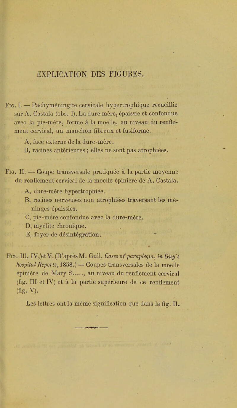 EXPLICATION DES FIGURES. Fig. I. — Pachyméningite cervicale hypertrophique recueillie sur A. Castala (obs. I).La dure-mère, épaissie et confondue avec la pie-mère, forme à la moelle, au niveau du renfle- ment cervical, un manchon fibreux et fusiforme. A, face externe de la dure-mère. B, racines antérieures ; elles ne sont pas atrophiées. Fig. II. — Coupe transversale pratiquée à la partie moyenne du renflement cervical de la moelle épinière de A. Castala. A, dure-mère hypertrophiée. B, racines nerveuses non atrophiées traversant les mé- ninges épaissies. C, pie-mère confondue avec la dure-mère. D, myélite chronique. E, foyer de désintégration. Fig. III, IV,'etV. (D’après M. Gull, Cases of paraplegia, in Guy’s hospital Reports, 1858.) — Coupes transversales de la moelle épinière de Mary S , au niveau du renflement cervical (fig. III et IV) et à la partie supérieure de ce renflement (fig. Y). Les lettres ont la même signification que dans la fig. IL
