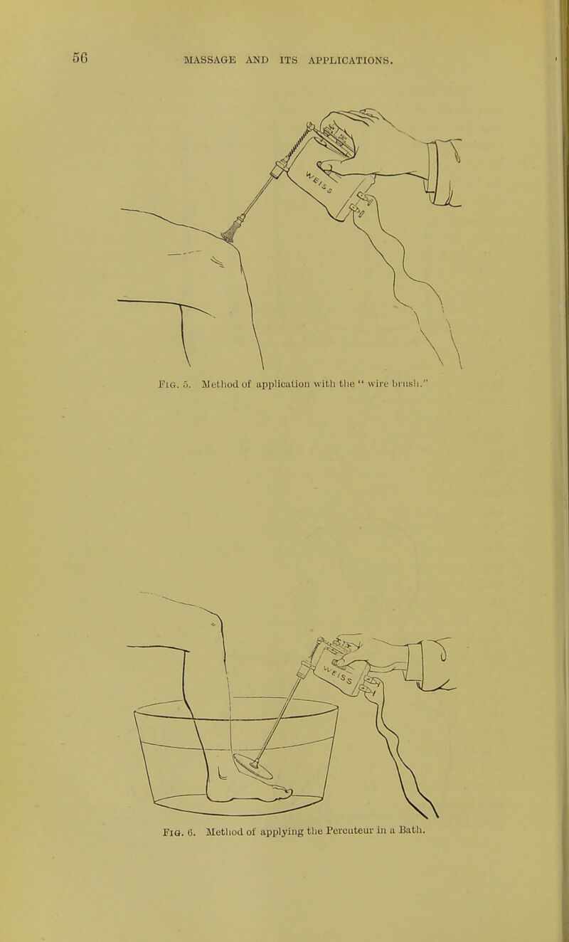 6. Metliod of applying the Peicuteur in a 13atli.
